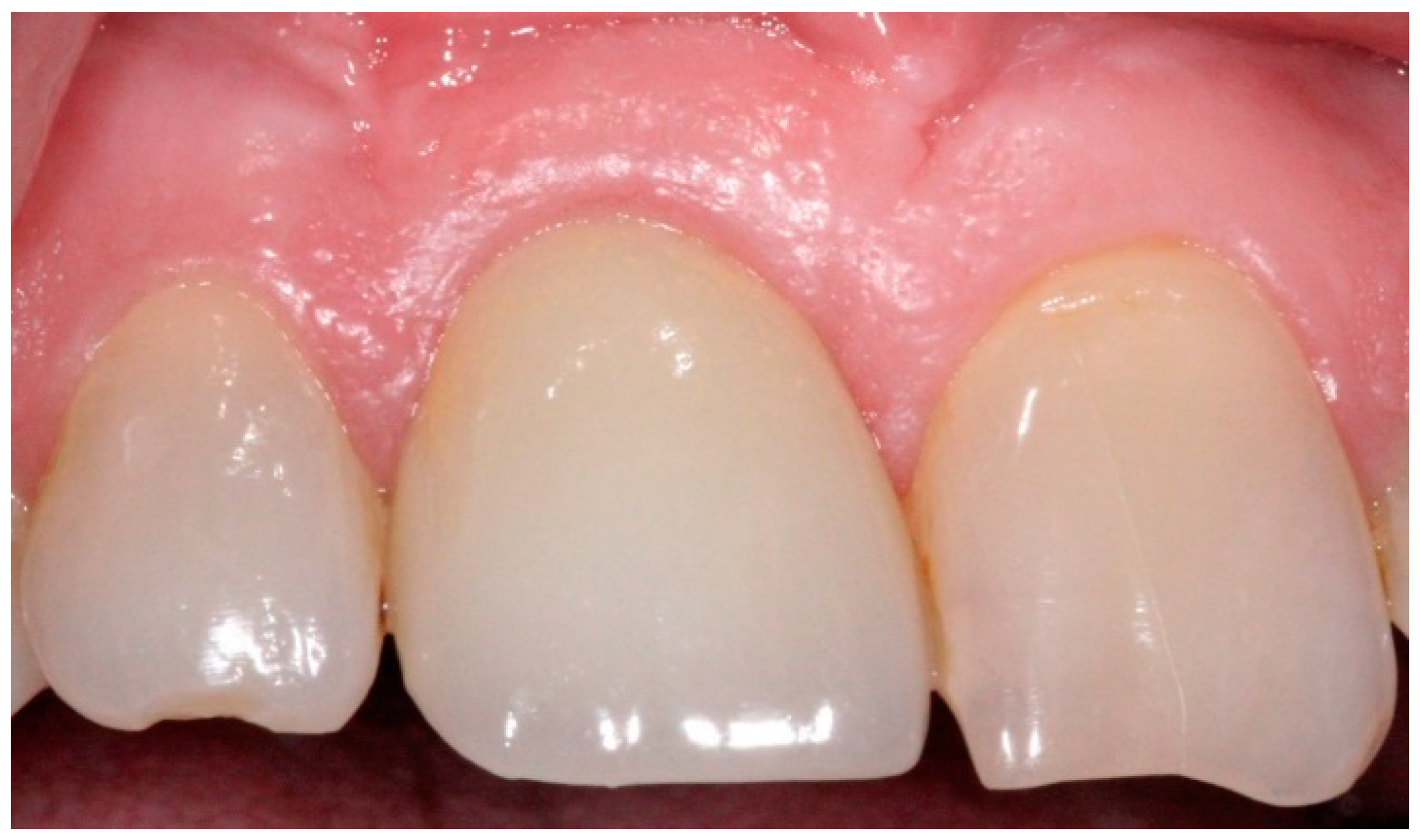 Dentistry 04 00014 g011 1024