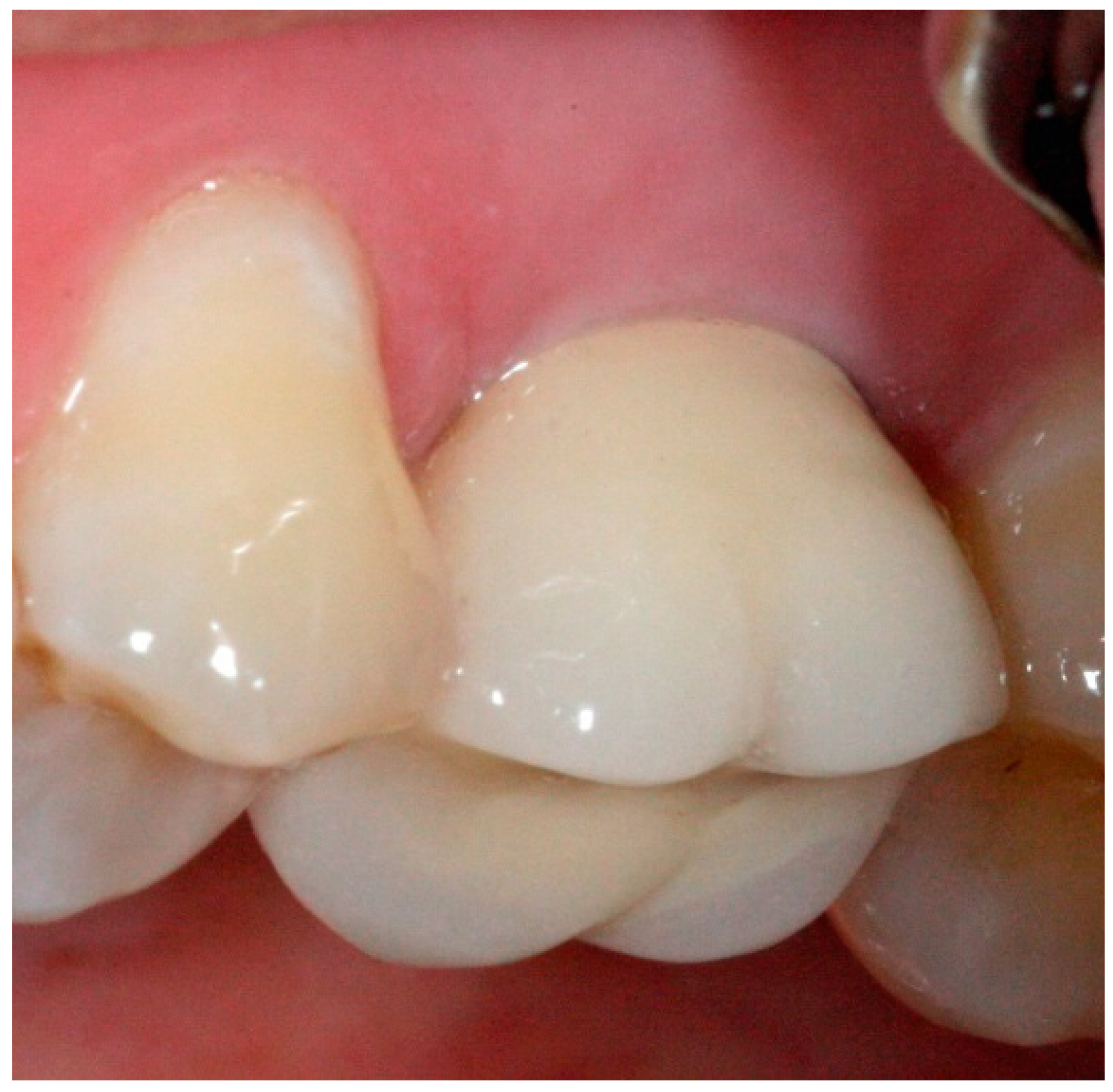 Dentistry 04 00014 g012 1024