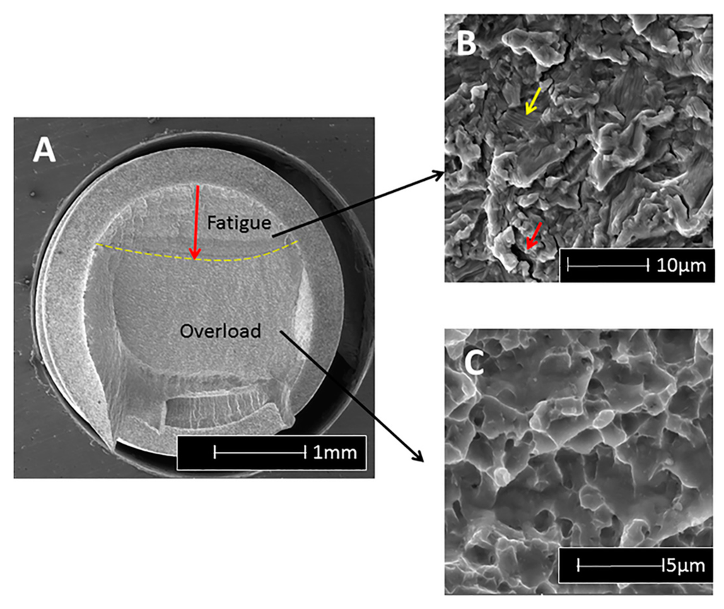 intaglio surface dentistry intaglio surface dentistry
