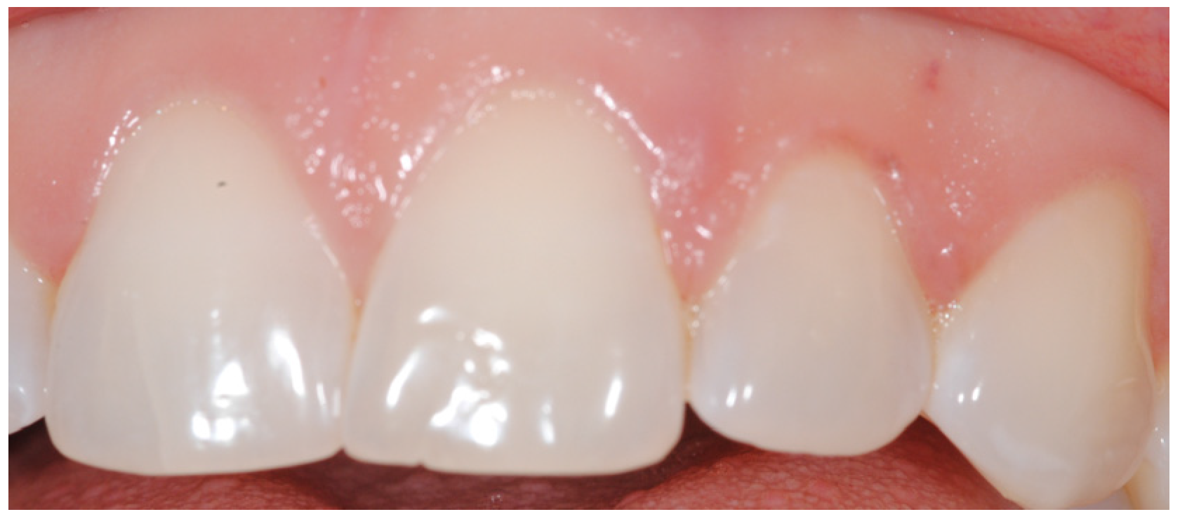 Dentistry 04 00022 g001