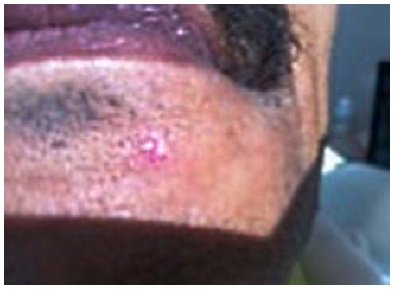 Dentistry 05 00010 g001 550