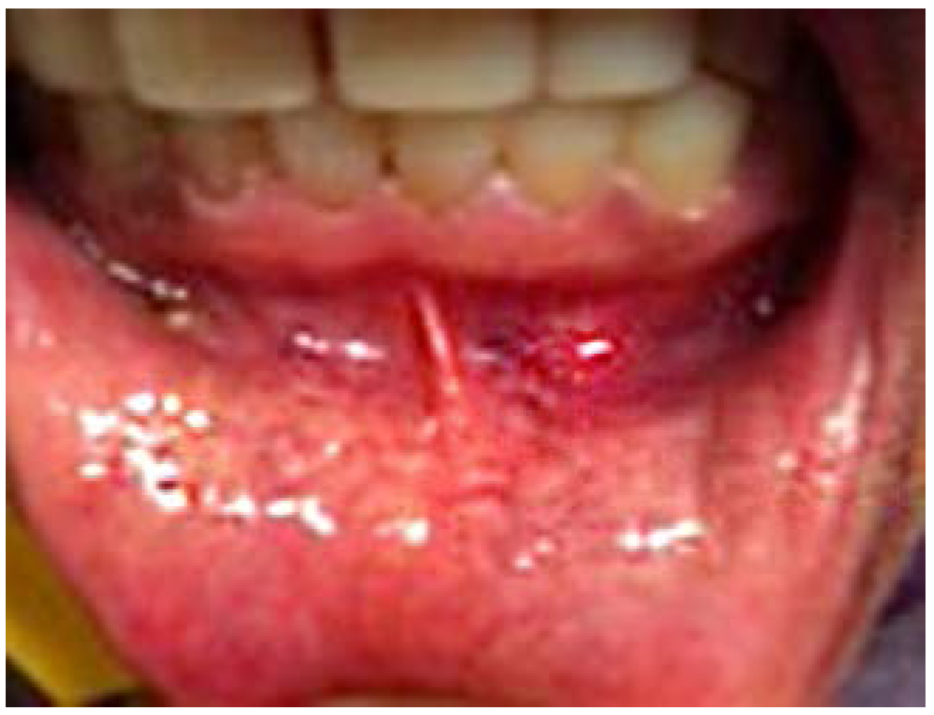 Dentistry 05 00010 g002 550