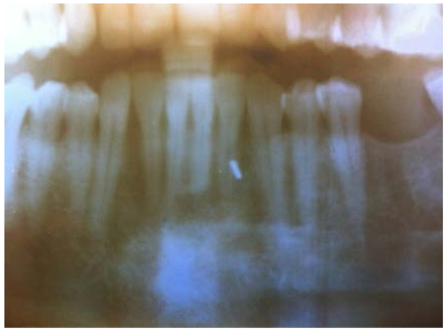 Dentistry 05 00010 g003 550