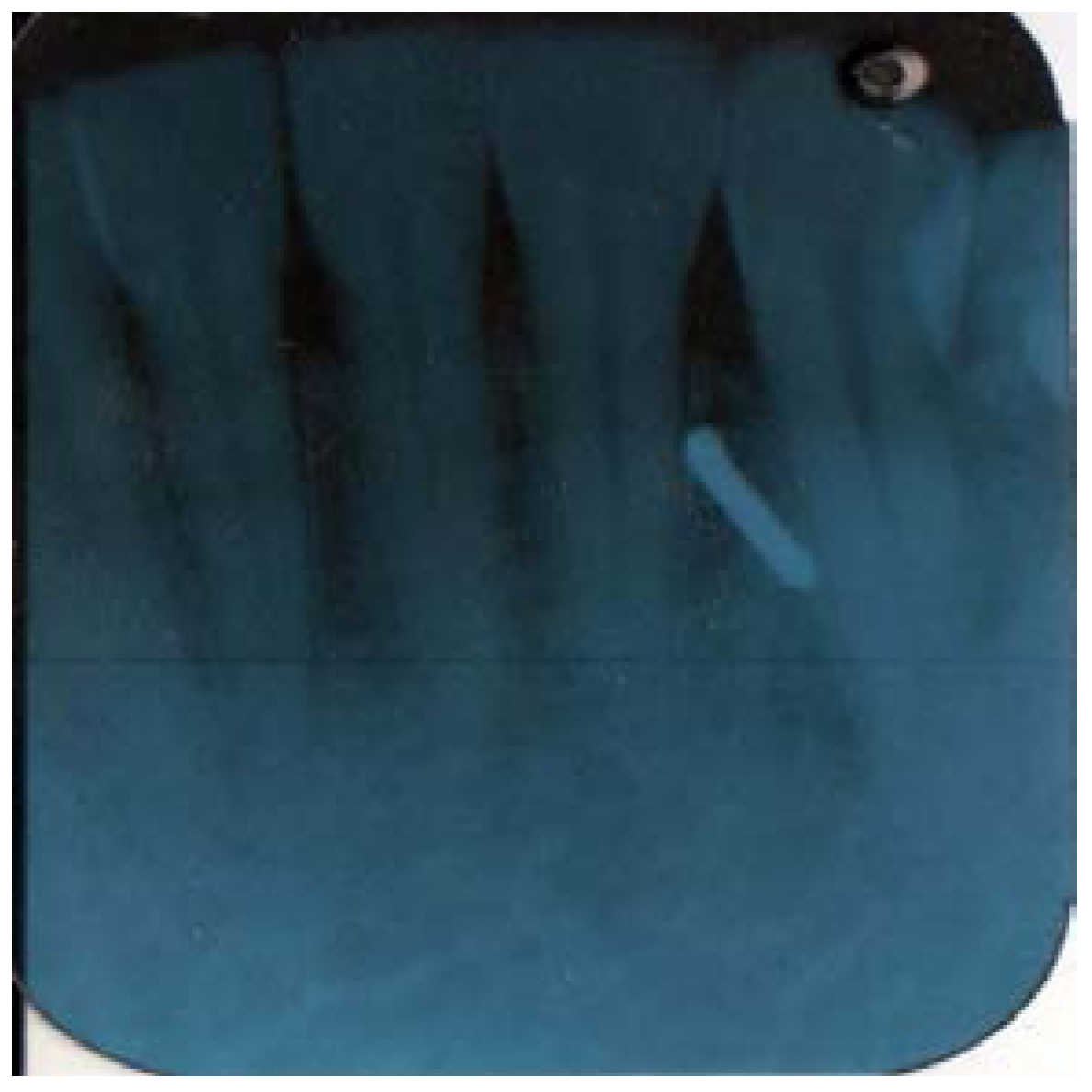 Dentistry 05 00010 g004 550