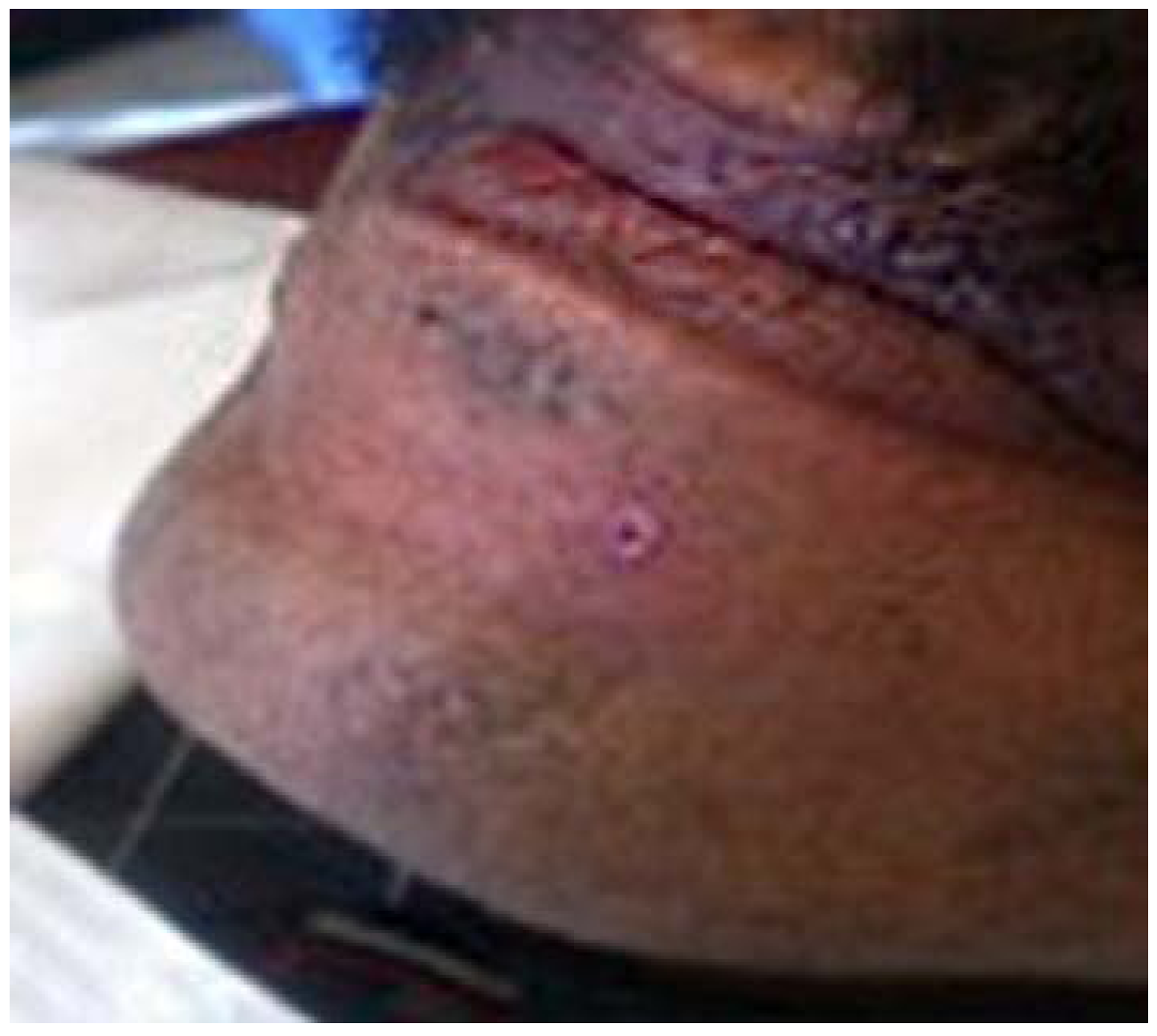 Dentistry 05 00010 g005 550