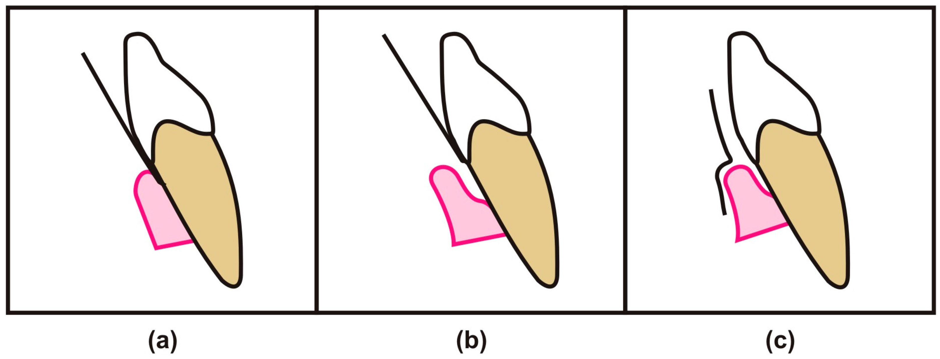 Dentistry 05 00012 g003