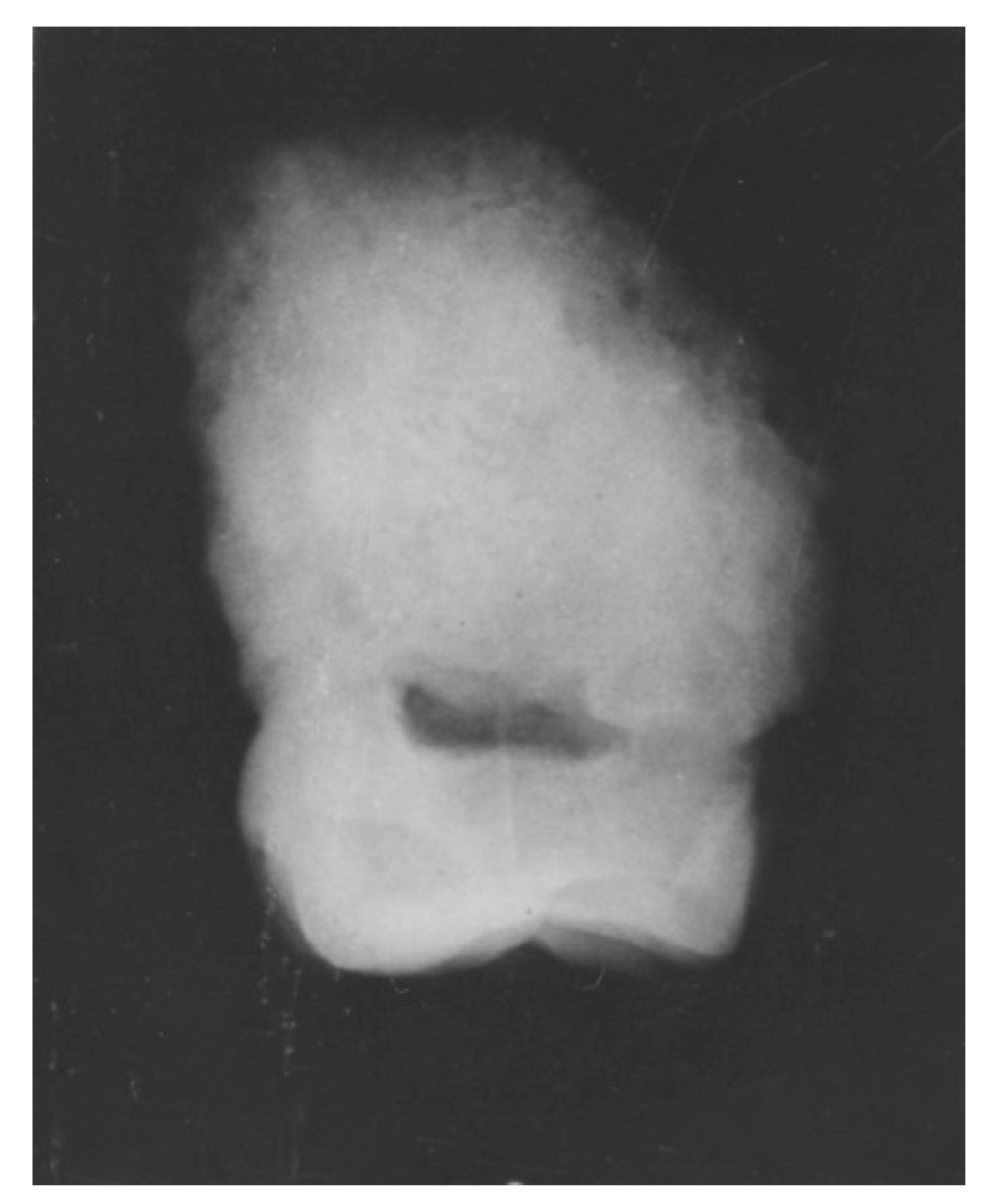Dentistry 05 00019 g002