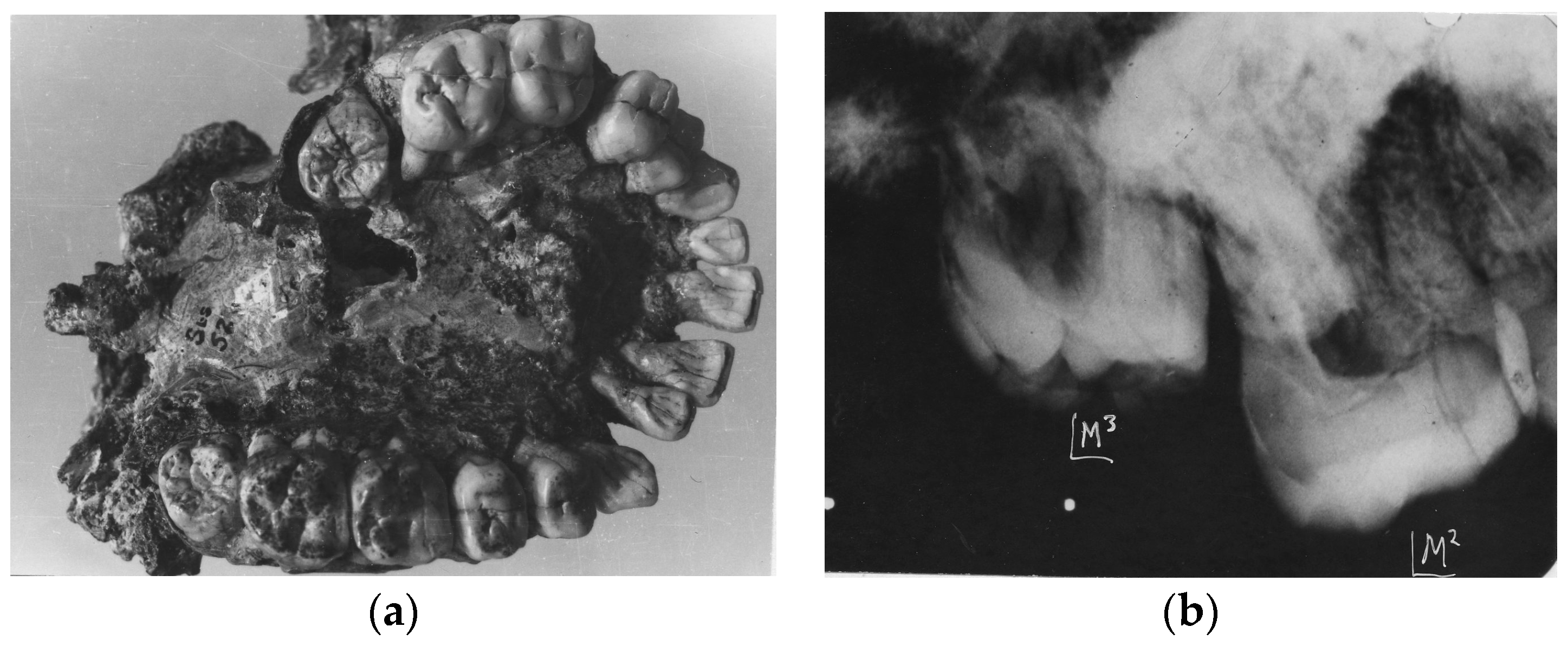 Dentistry 05 00019 g003