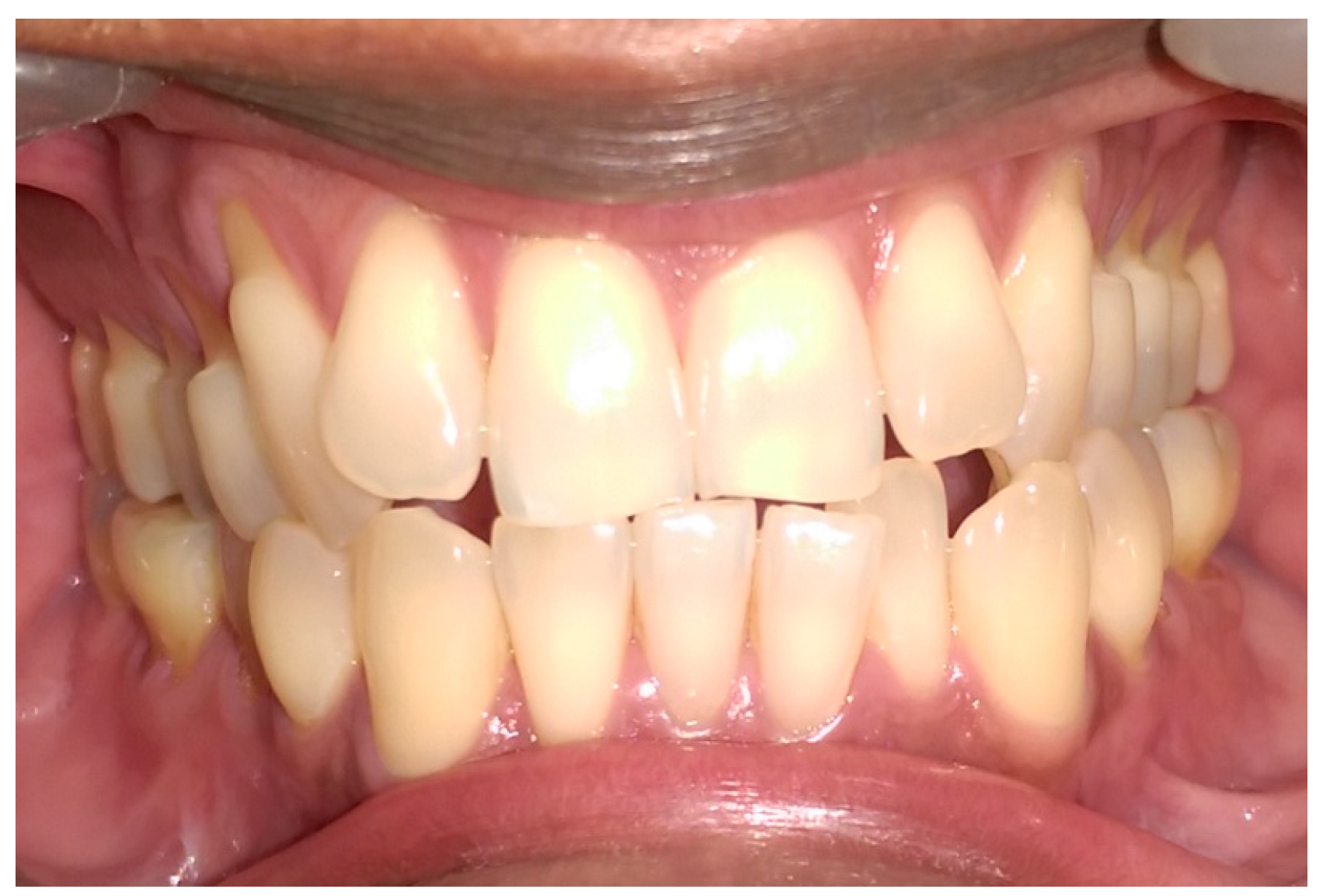 Dentistry 05 00033 g001