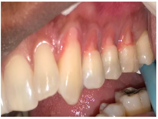 Dentistry 05 00033 g002 550