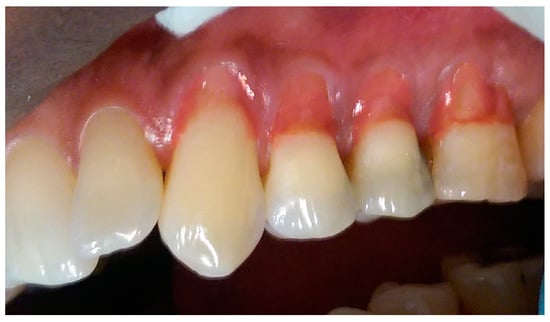 Dentistry 05 00033 g004 550