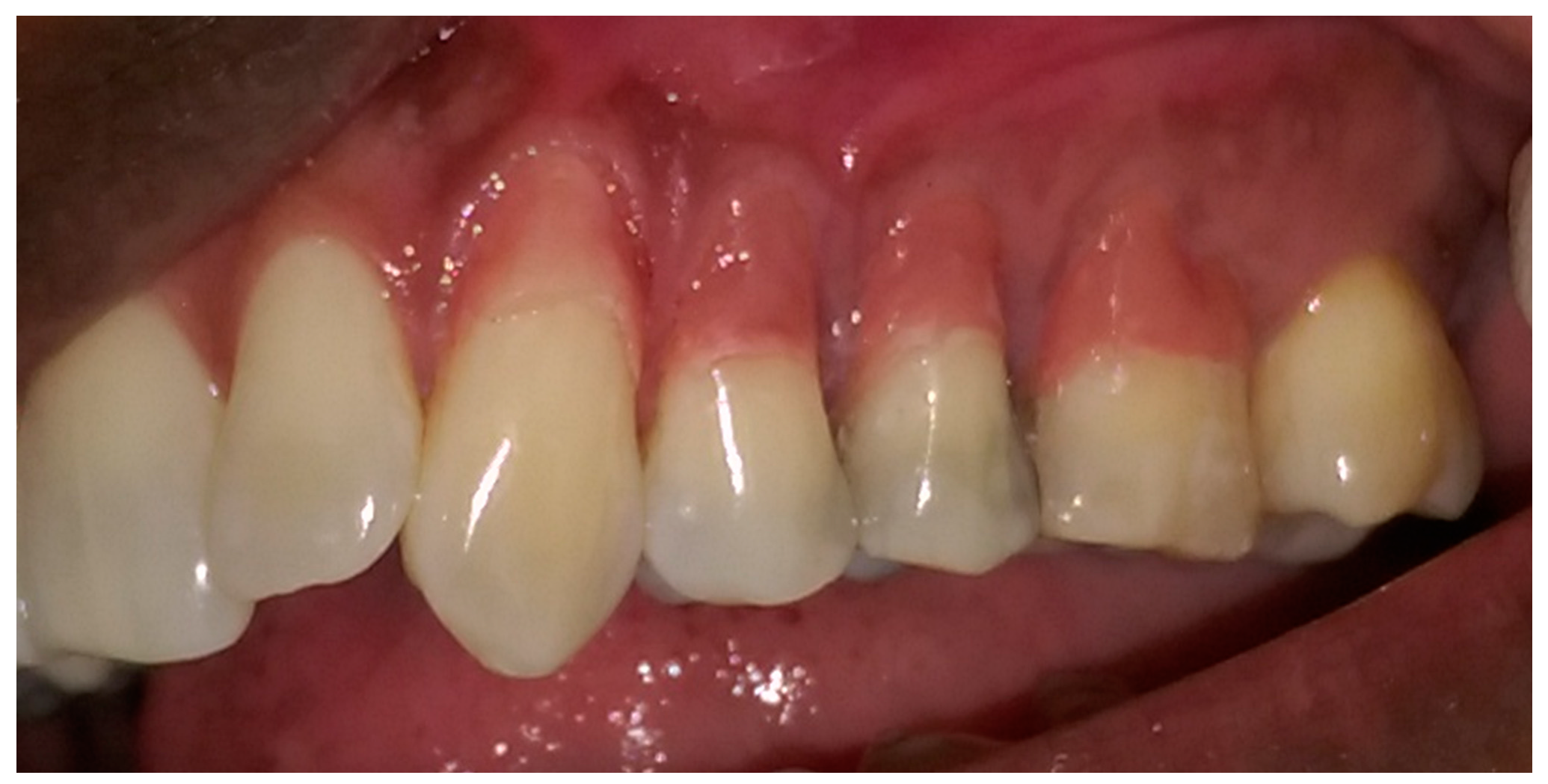 Dentistry 05 00033 g006