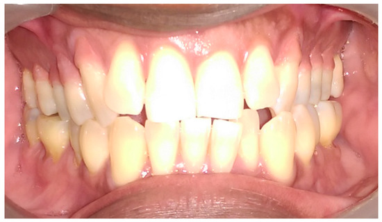 Dentistry 05 00033 g007 550
