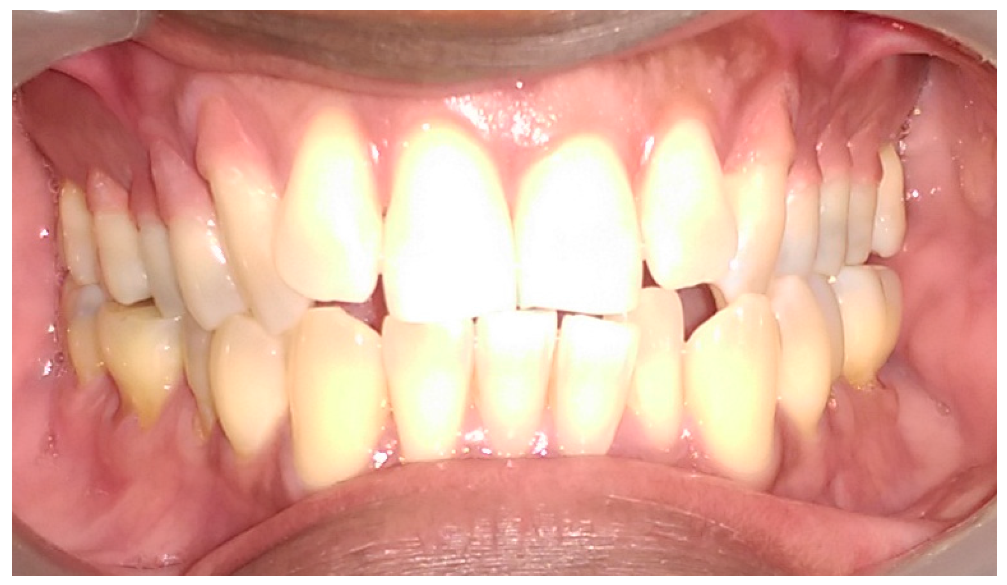 Dentistry 05 00033 g007