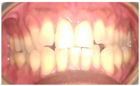Dentistry 05 00033 g008 550