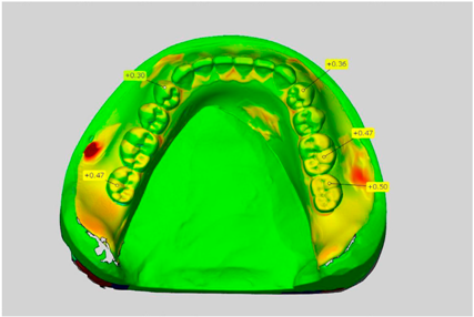 Dentistry 05 00036 i009