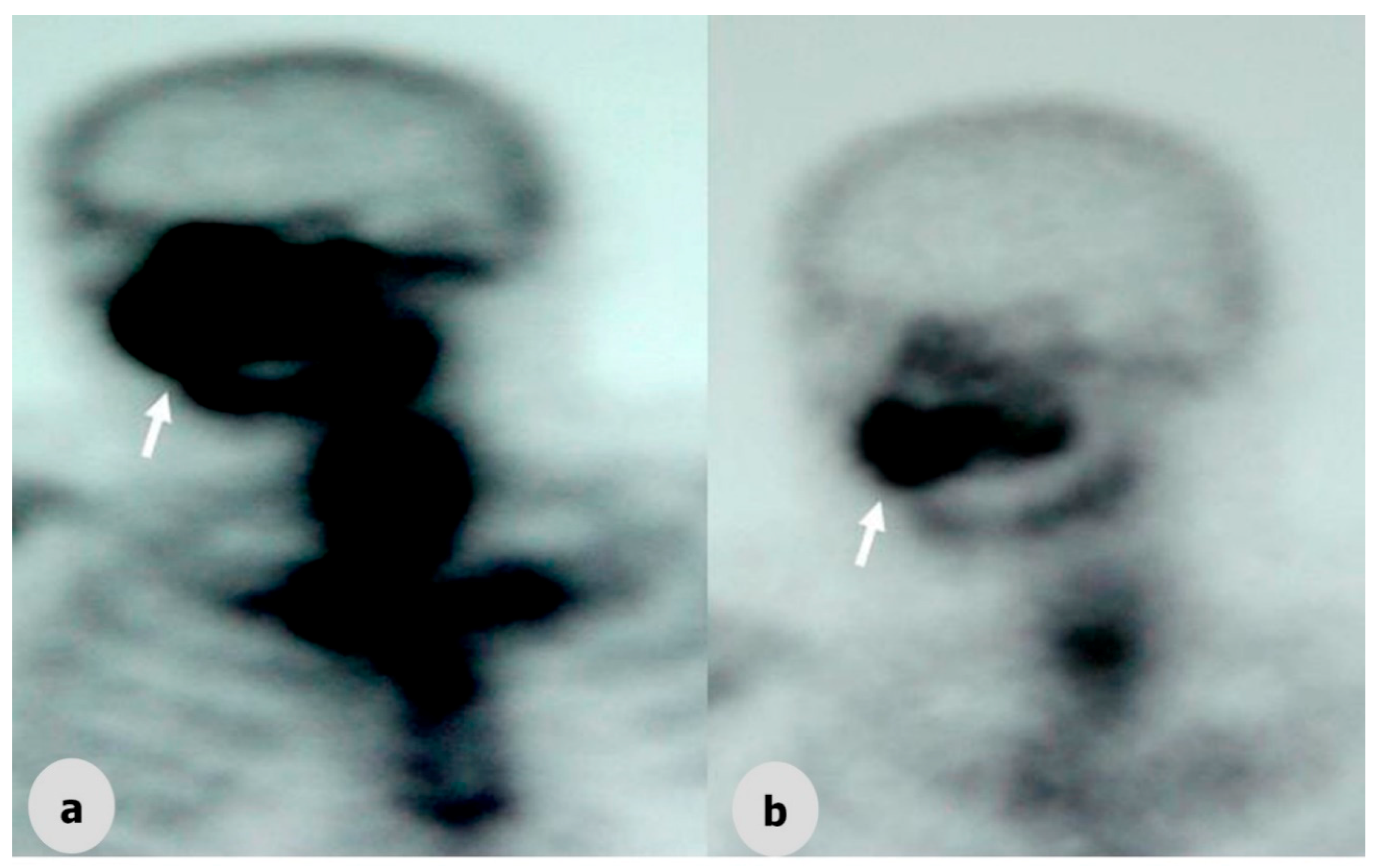 Dentistry 06 00022 g003 550