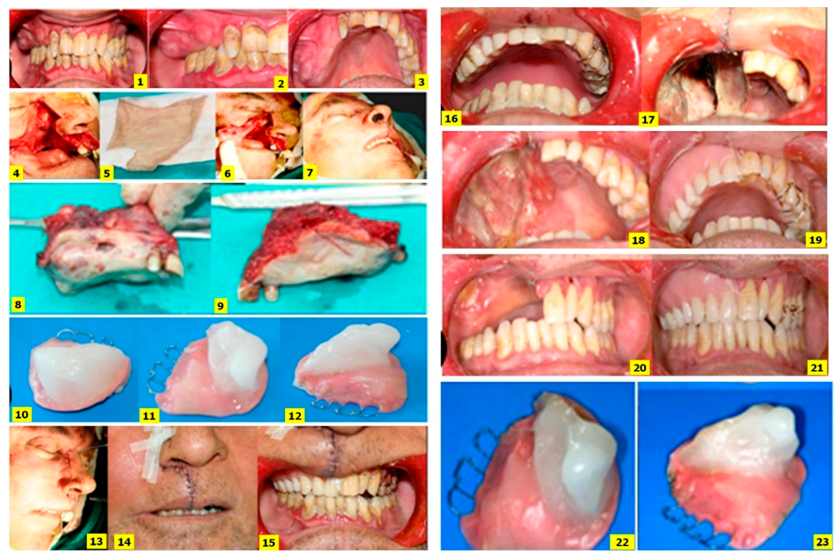 Dentistry 06 00022 g005 550