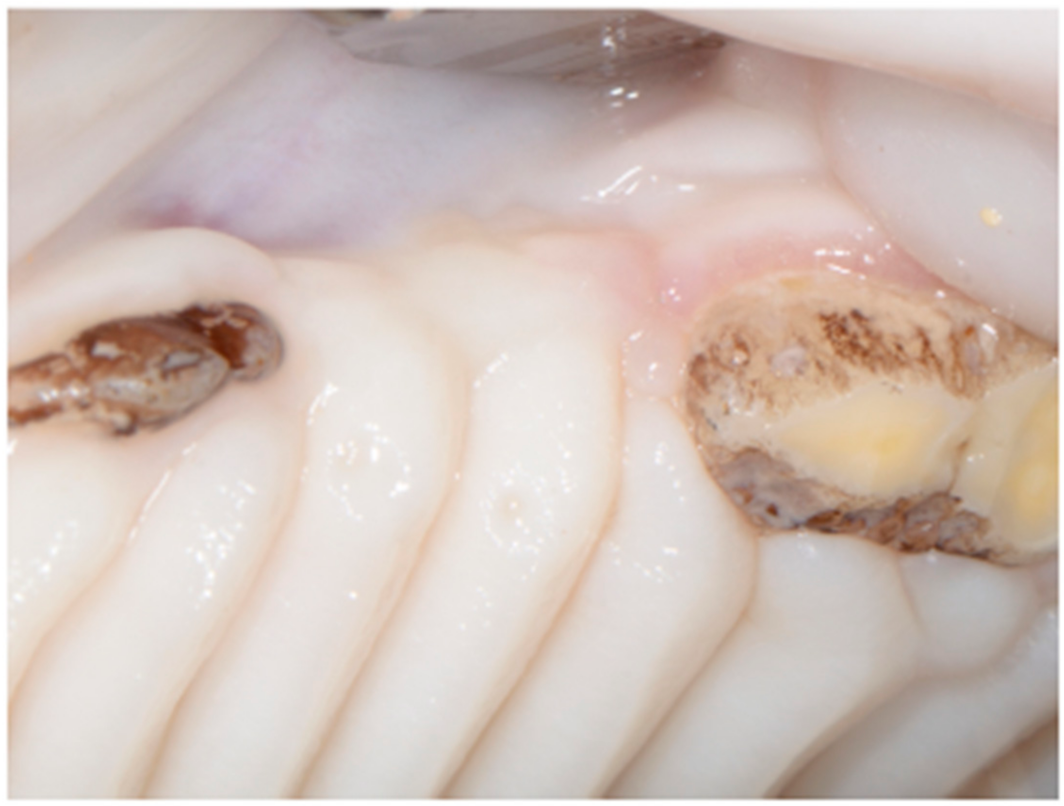 Dentistry 06 00027 g003 Dentistry 06 00027 g003