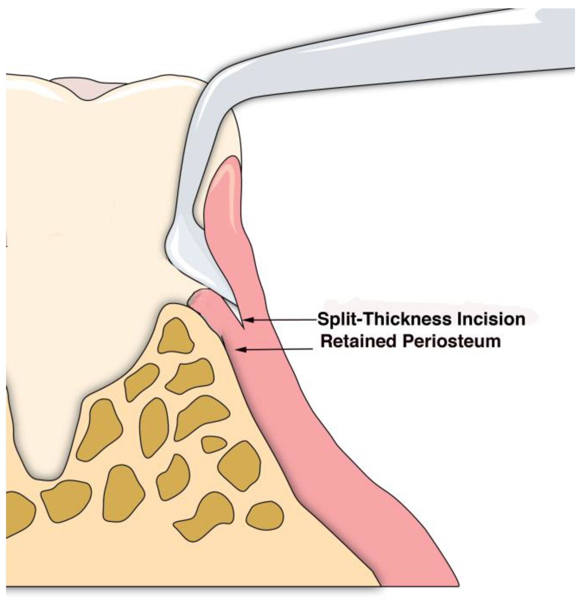 Dentistry 06 00030 g003