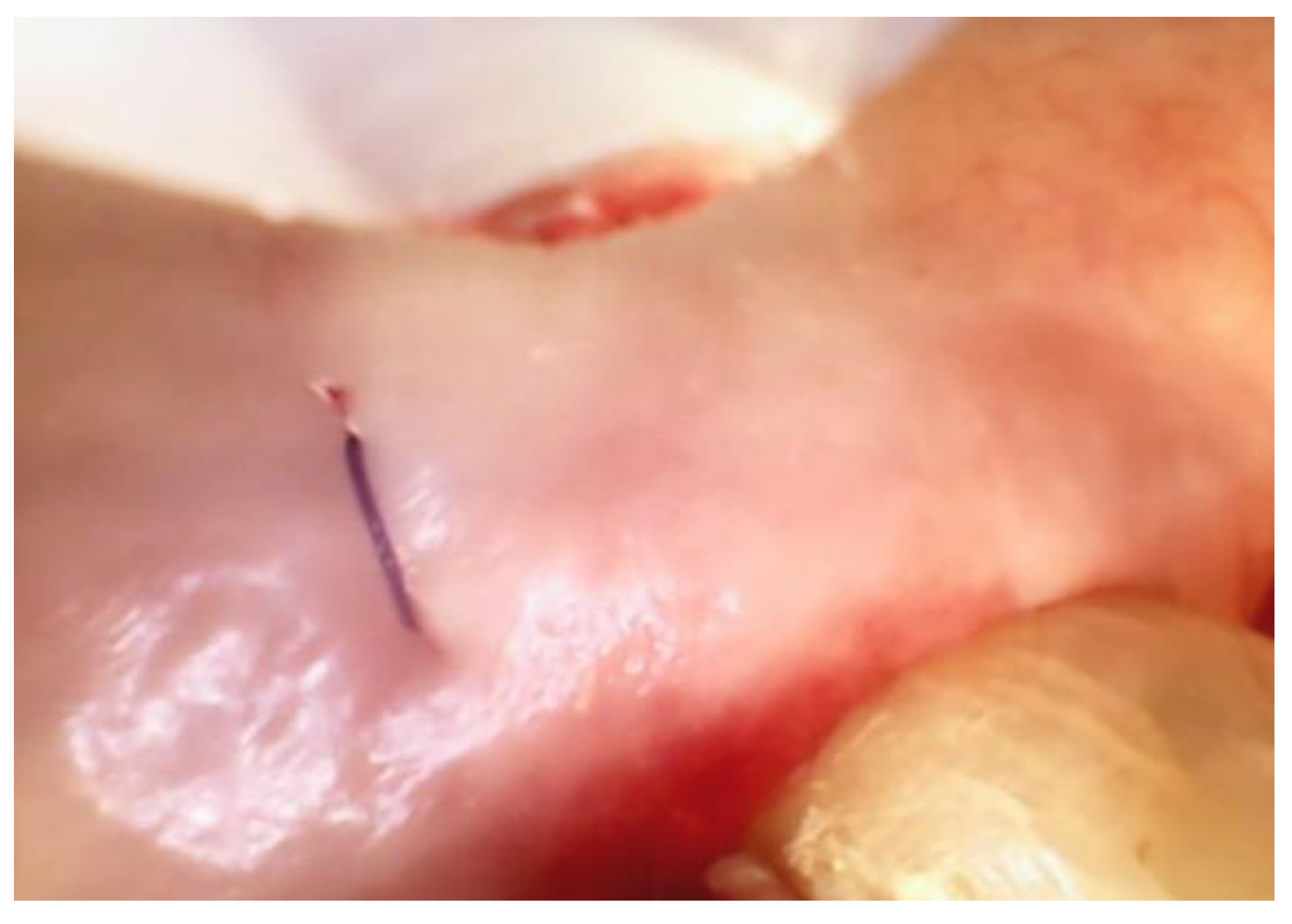 Dentistry 06 00030 g005