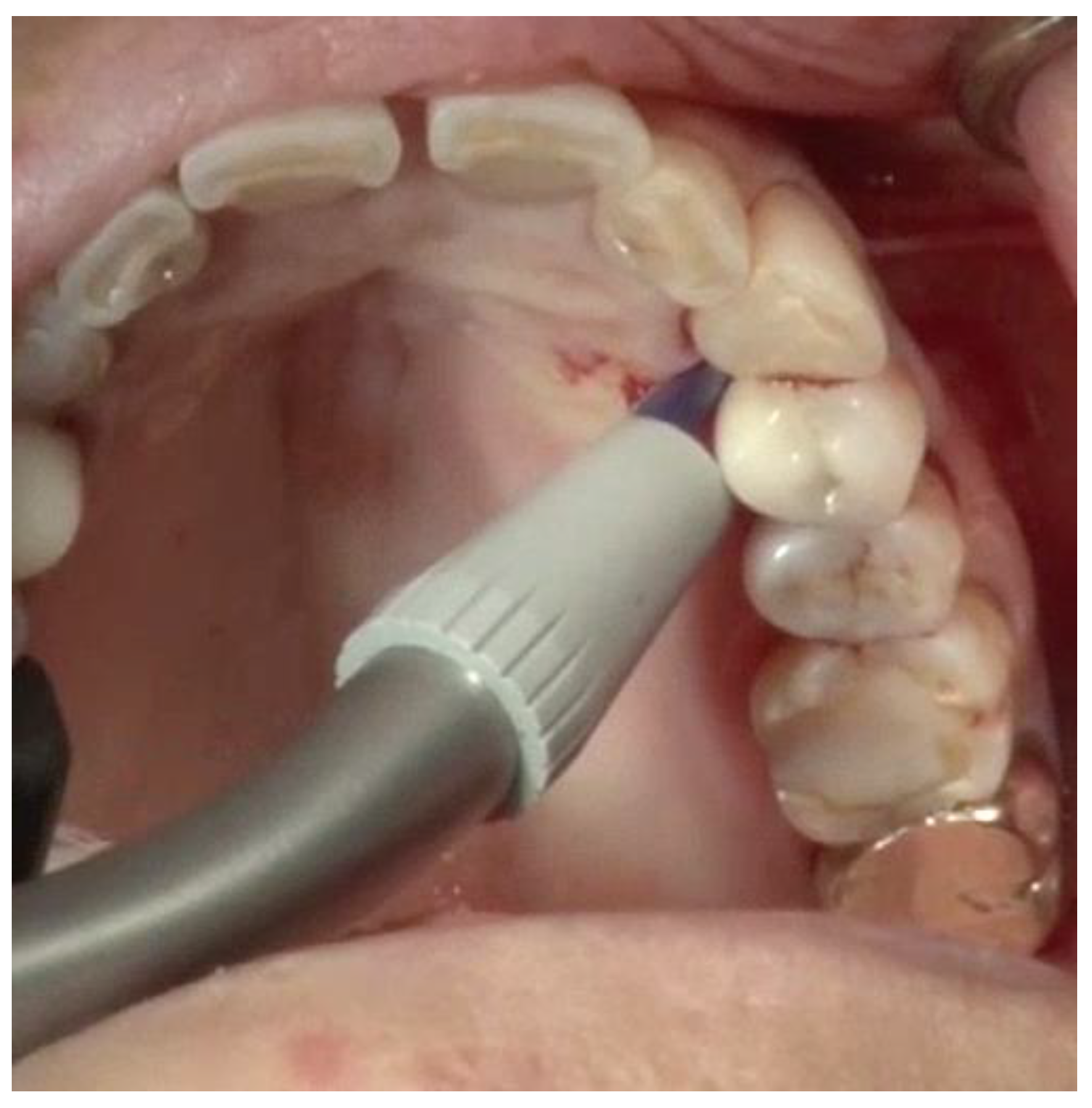 Dentistry 06 00030 g006