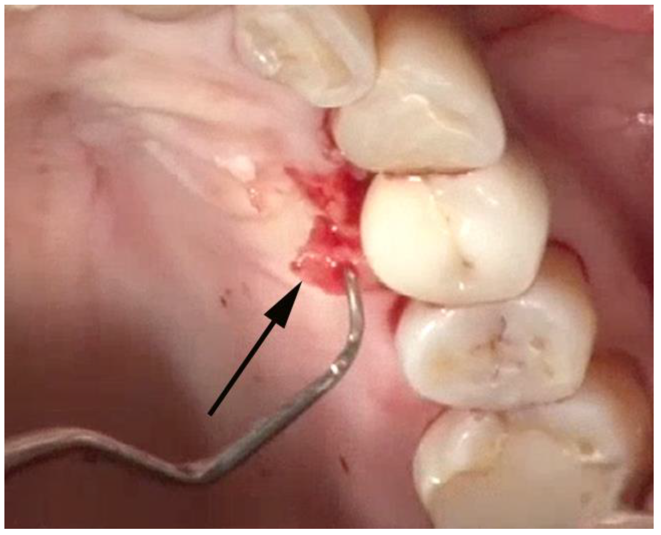 Dentistry 06 00030 g007