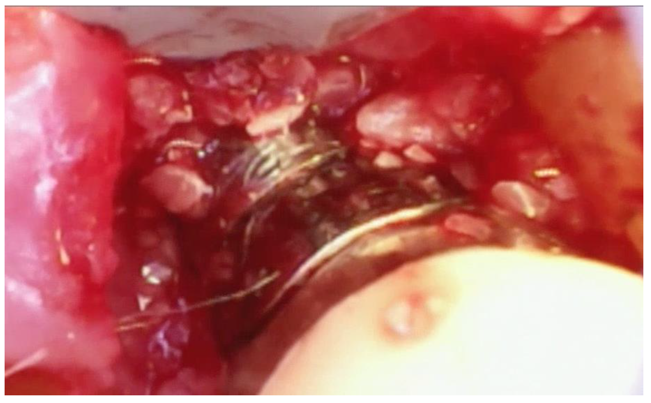 Dentistry 06 00030 g009