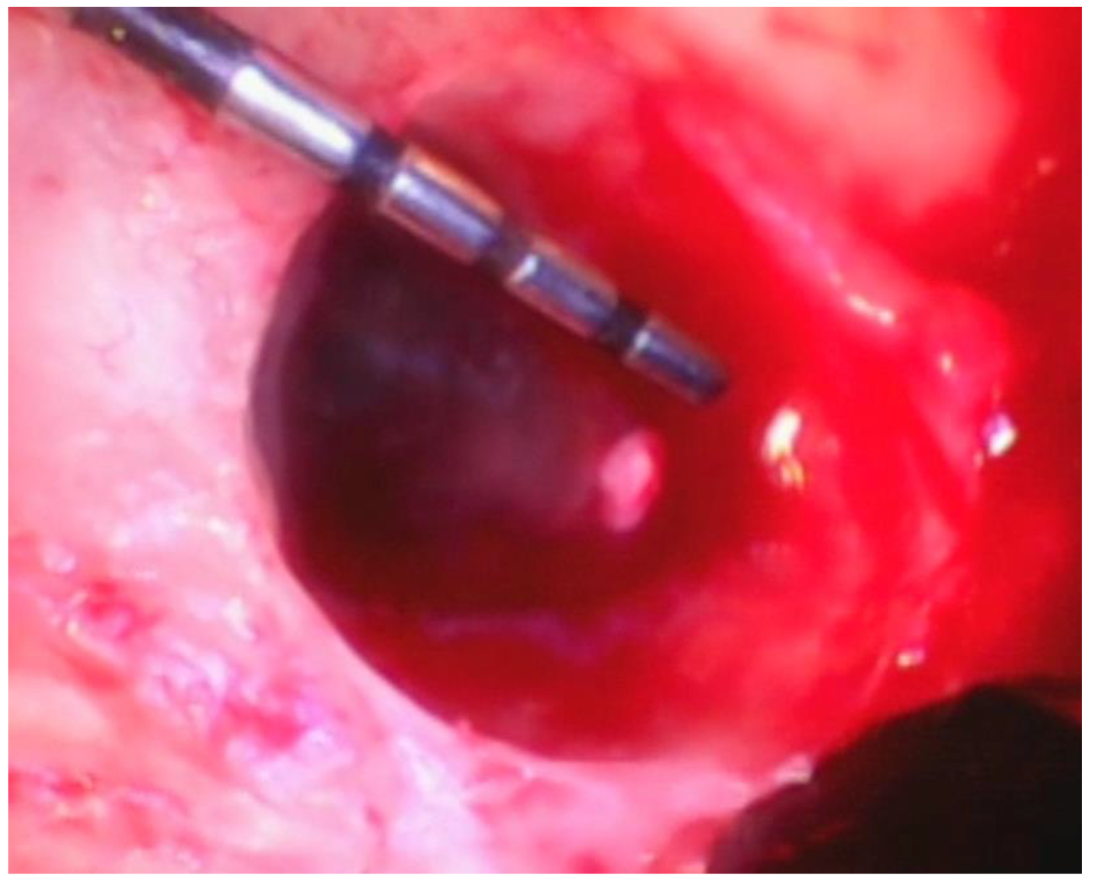 Dentistry 06 00030 g010