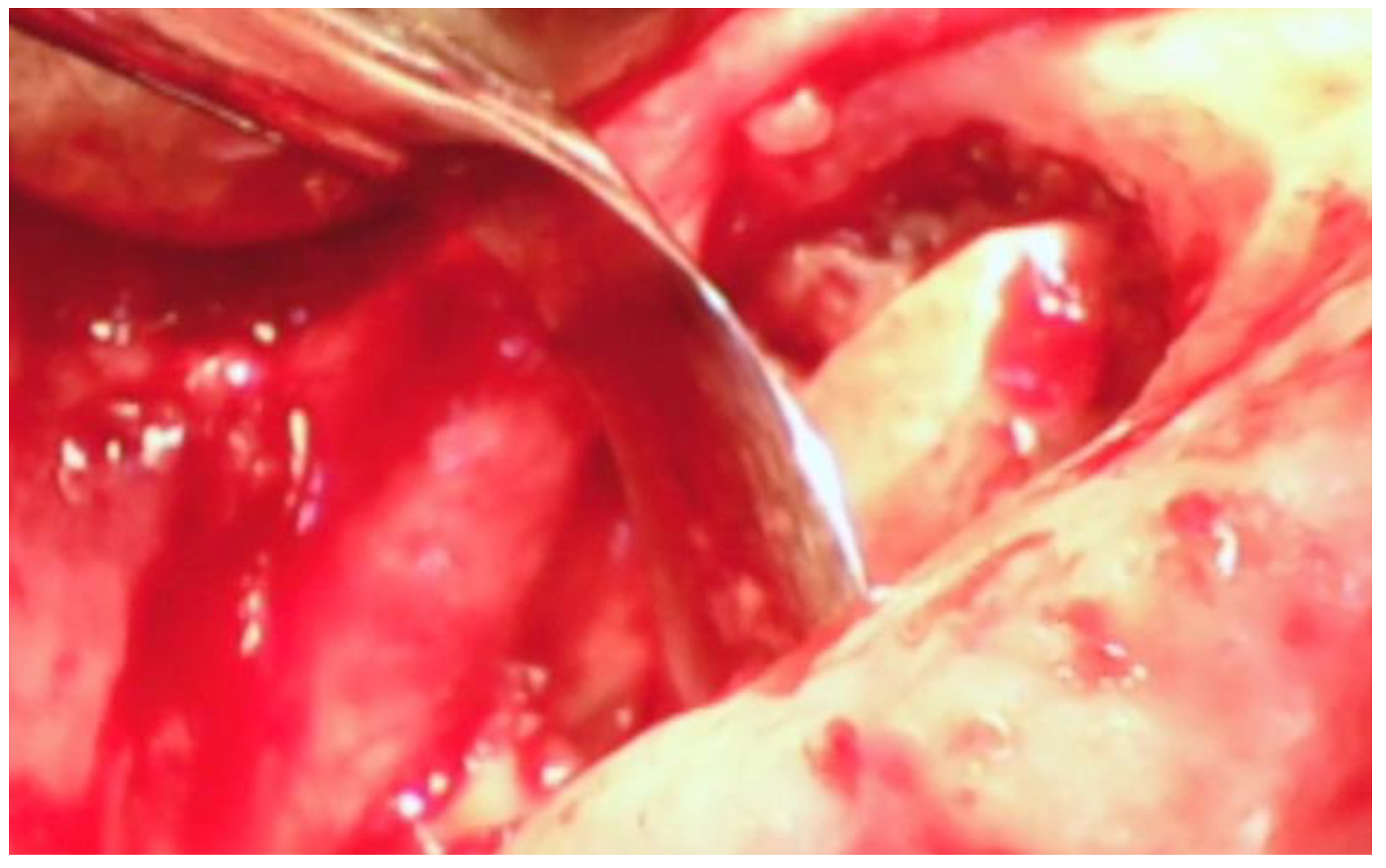 Dentistry 06 00030 g011