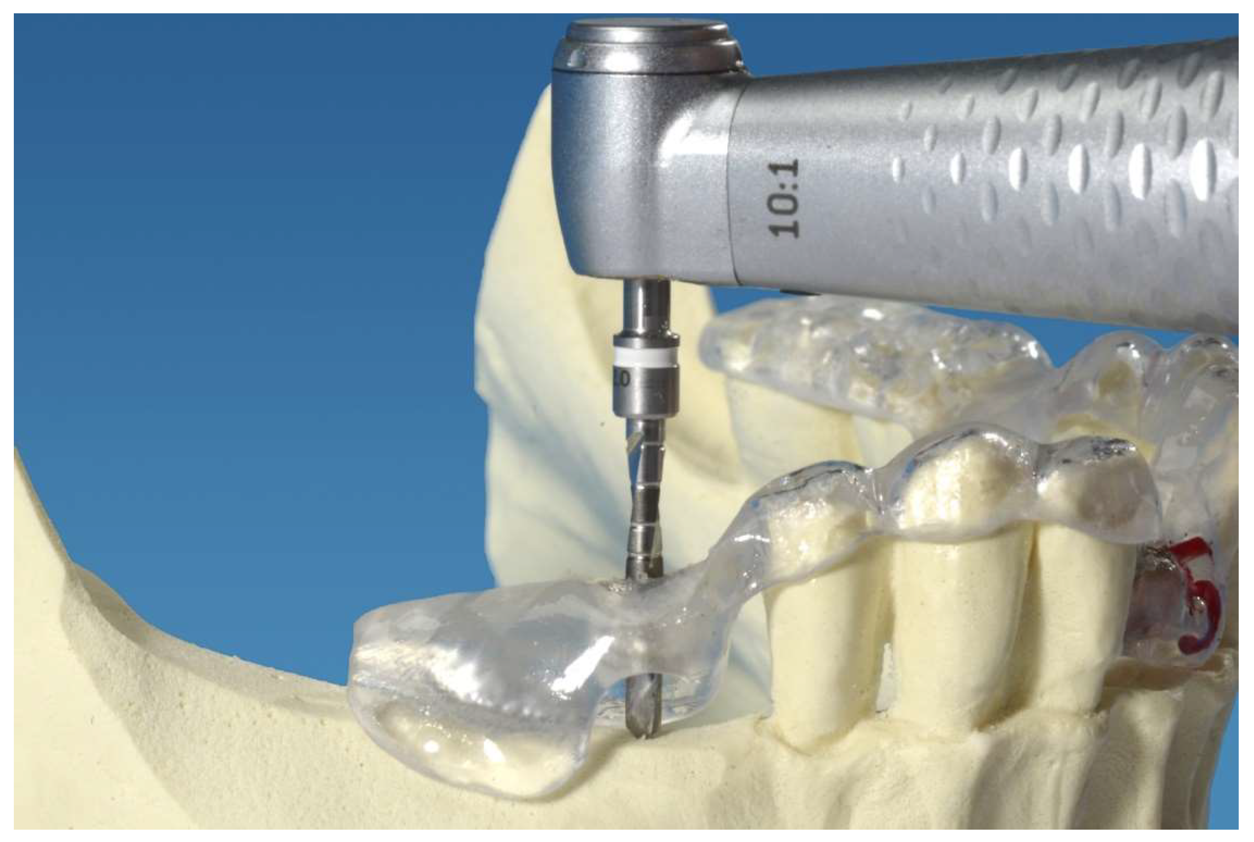 Dentistry 06 00043 g001