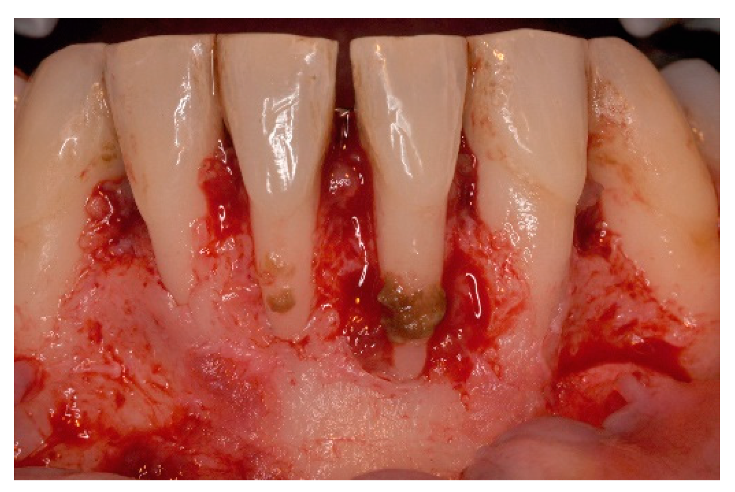 Dentistry 06 00050 g003 Dentistry 06 00050 g003