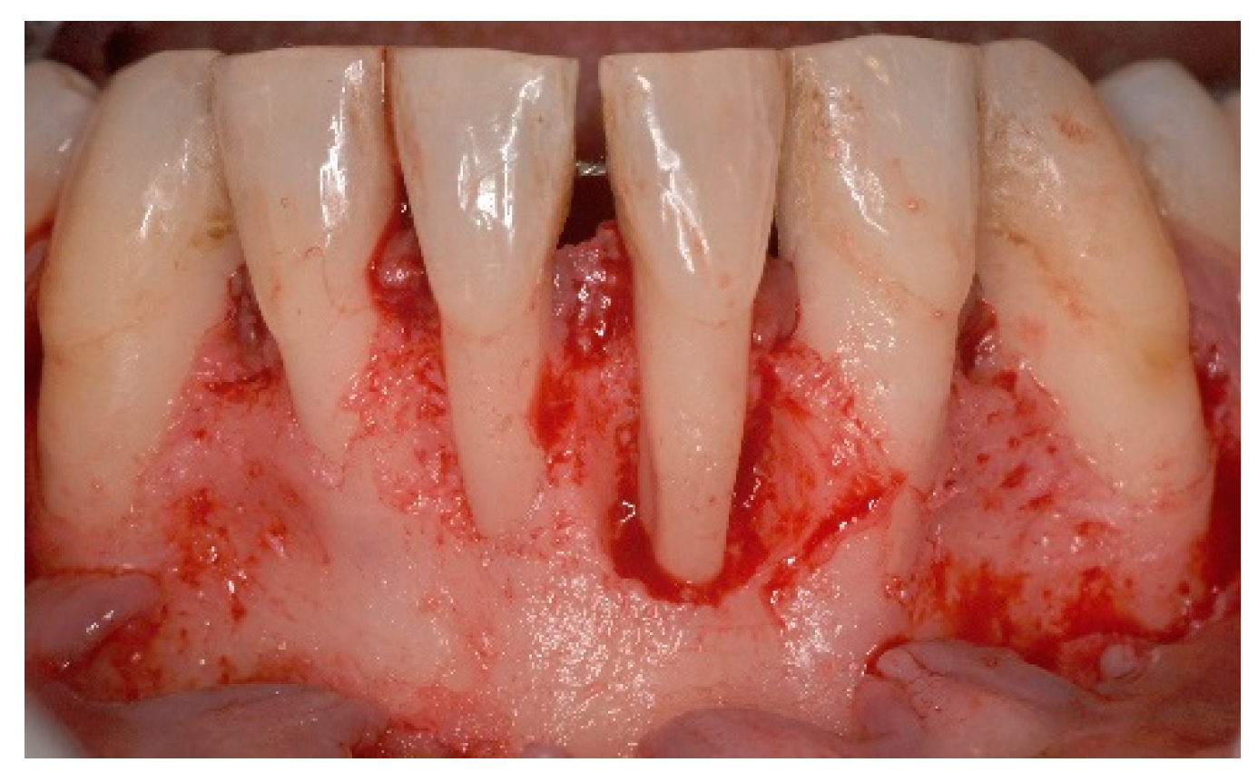 Dentistry 06 00050 g004 Dentistry 06 00050 g004