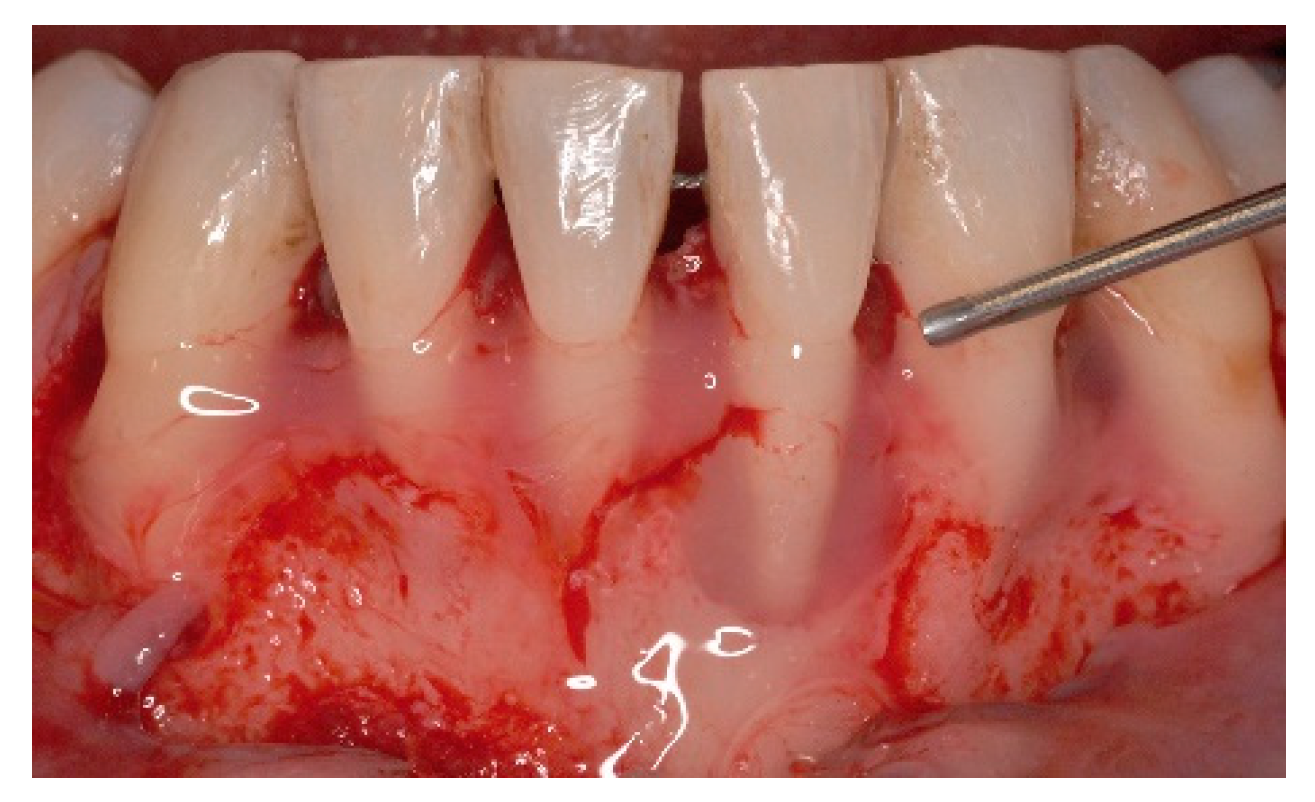 Dentistry 06 00050 g005 Dentistry 06 00050 g005