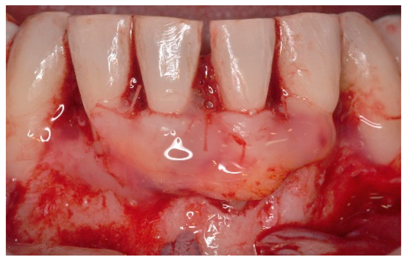 Dentistry 06 00050 g007 Dentistry 06 00050 g007
