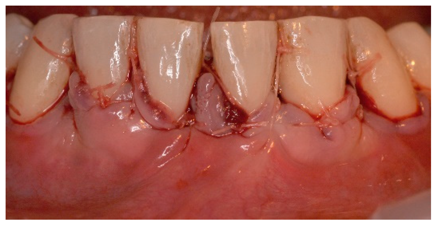 Dentistry 06 00050 g008 Dentistry 06 00050 g008