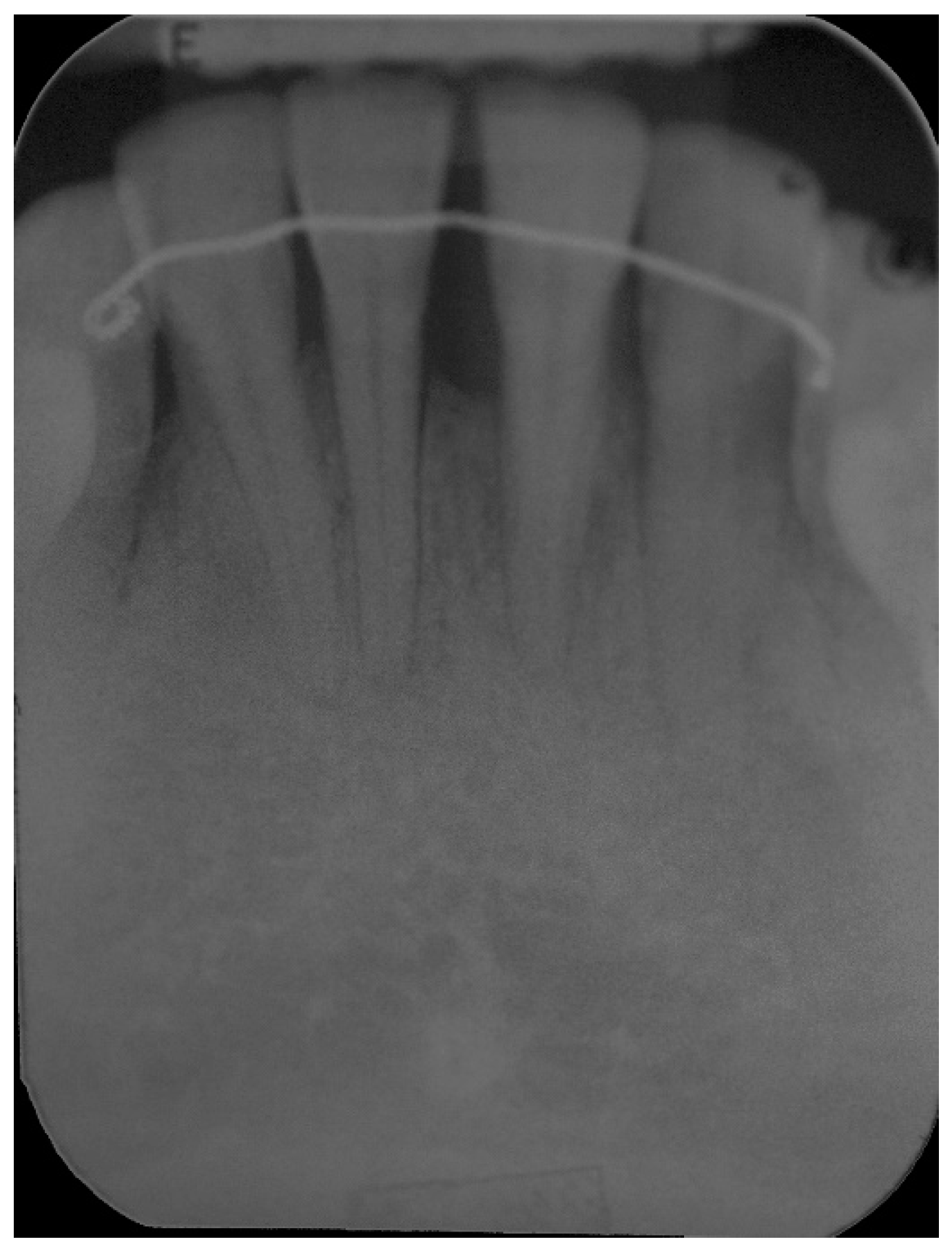 Dentistry 06 00050 g010 Dentistry 06 00050 g010