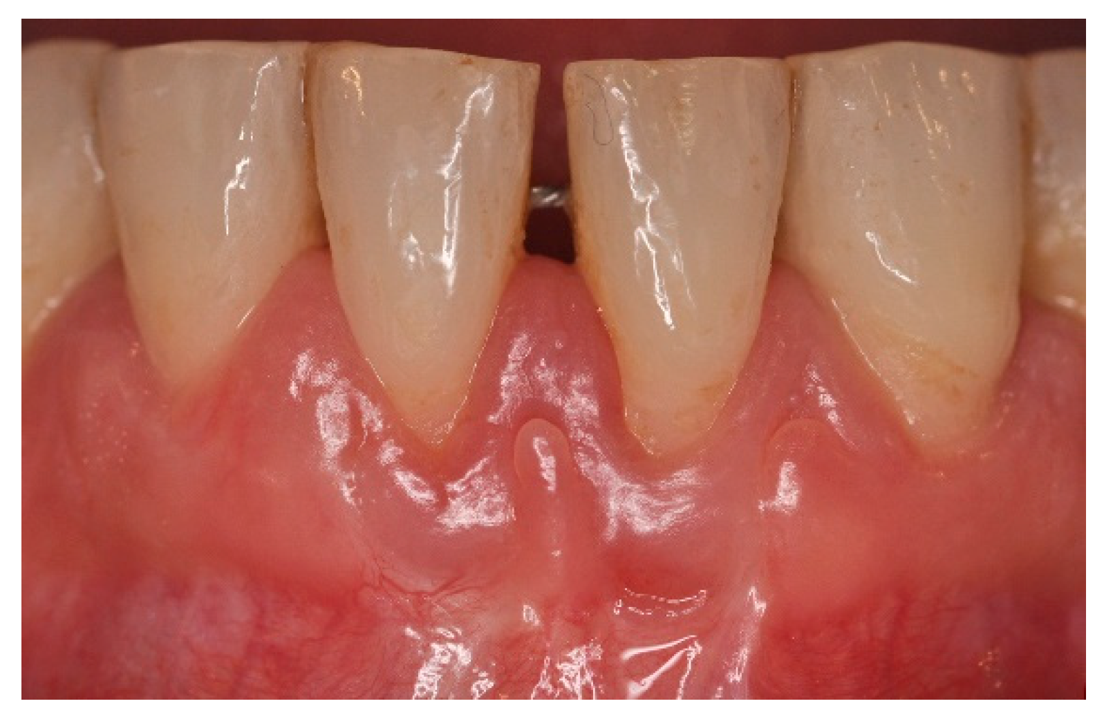 Dentistry 06 00050 g011 Dentistry 06 00050 g011