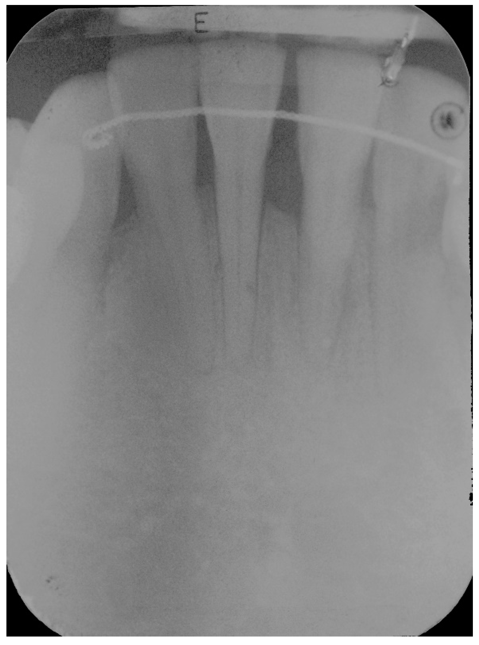 Dentistry 06 00050 g014 Dentistry 06 00050 g014