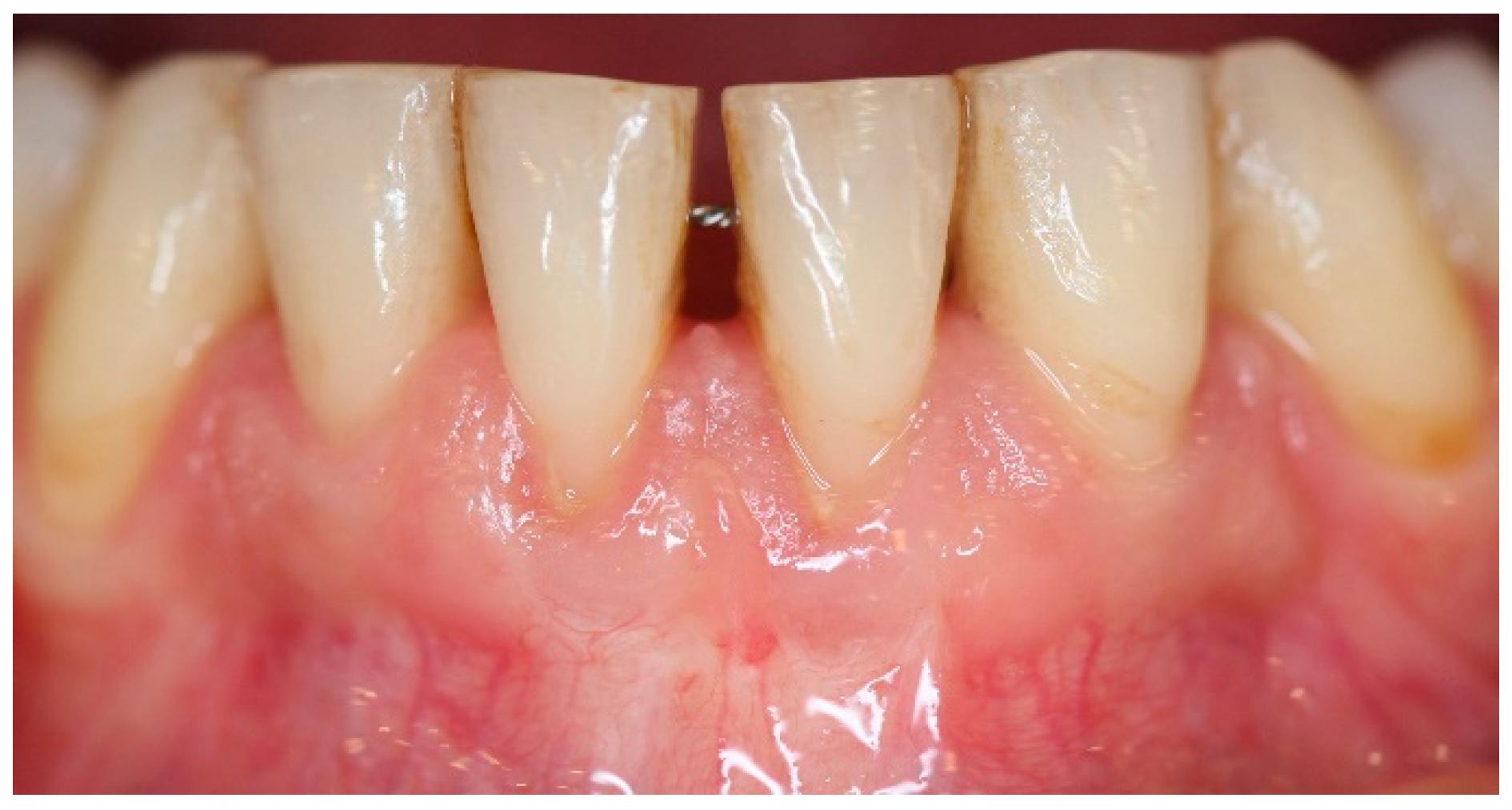 Dentistry 06 00050 g015 Dentistry 06 00050 g015