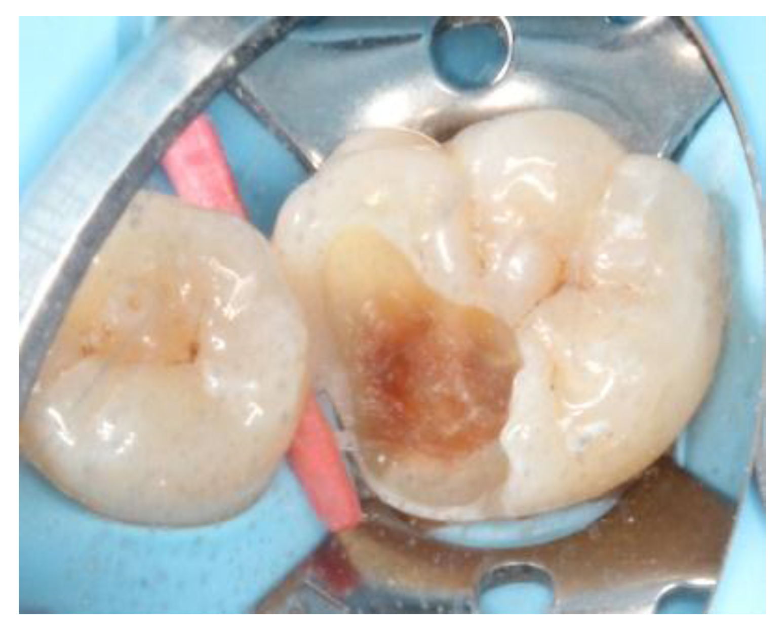 Dentistry 06 00054 g003 550