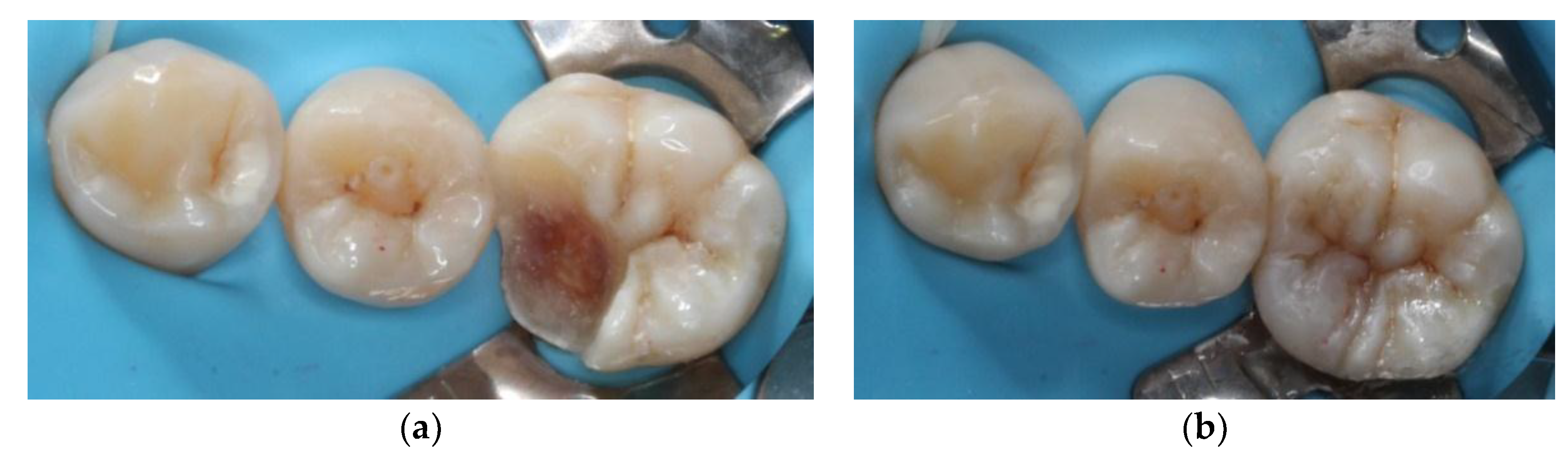 Dentistry 06 00054 g005 550