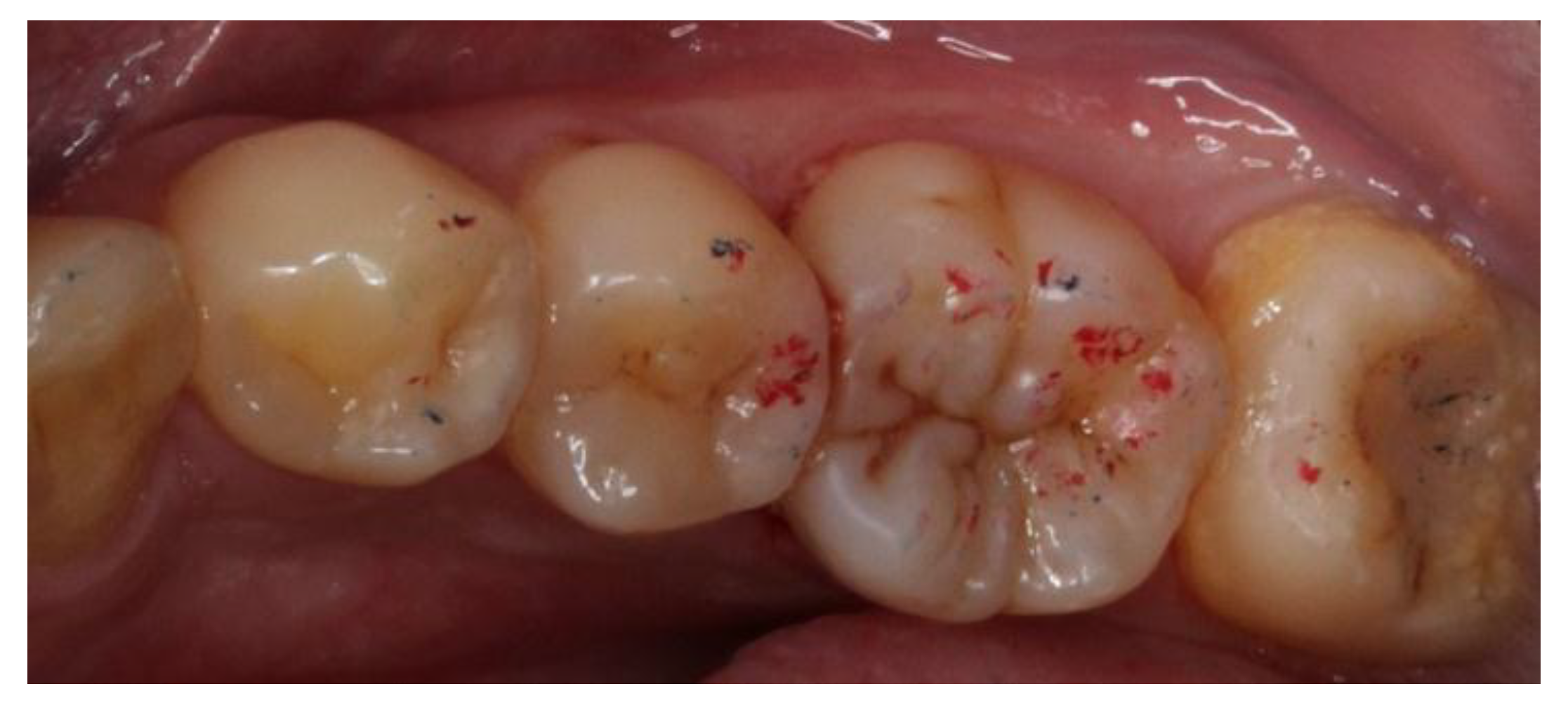 Dentistry 06 00054 g006 550