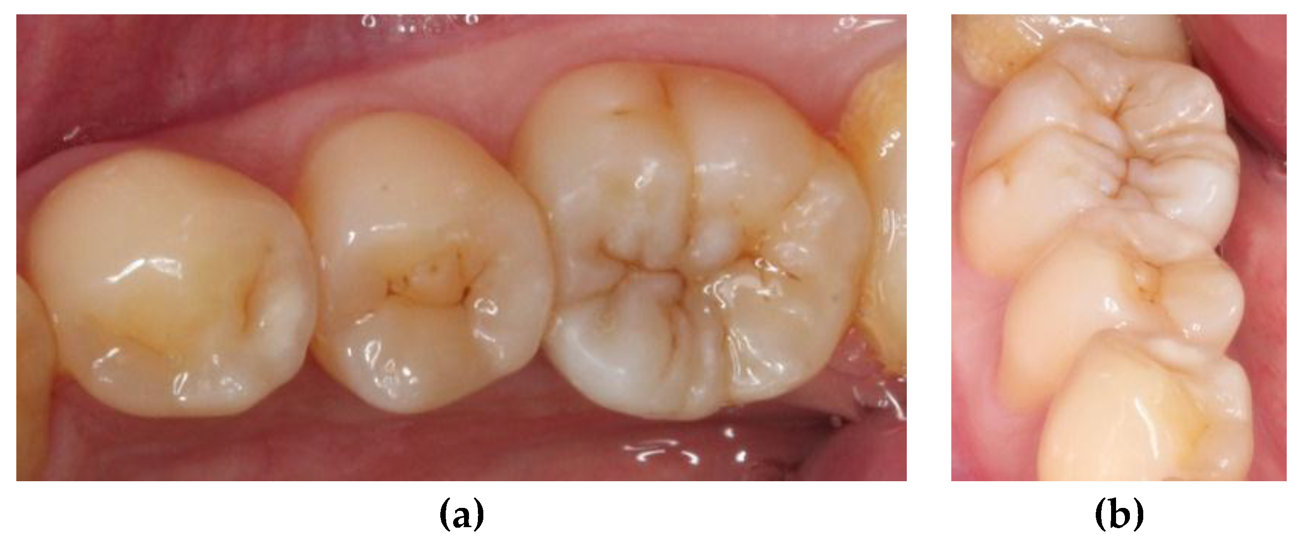 Dentistry 06 00054 g007 550