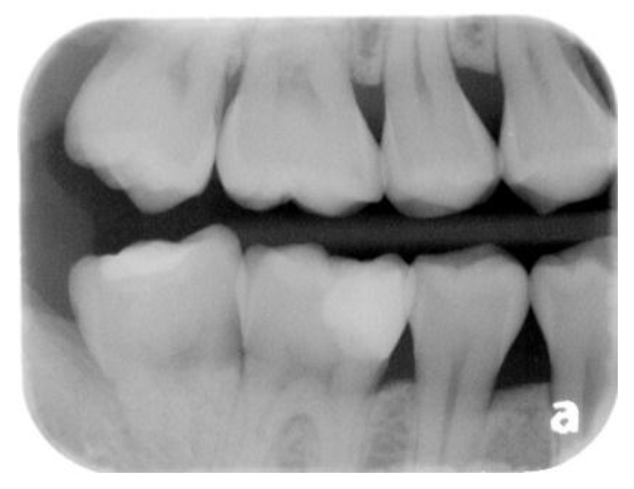 Dentistry 06 00054 g008 550