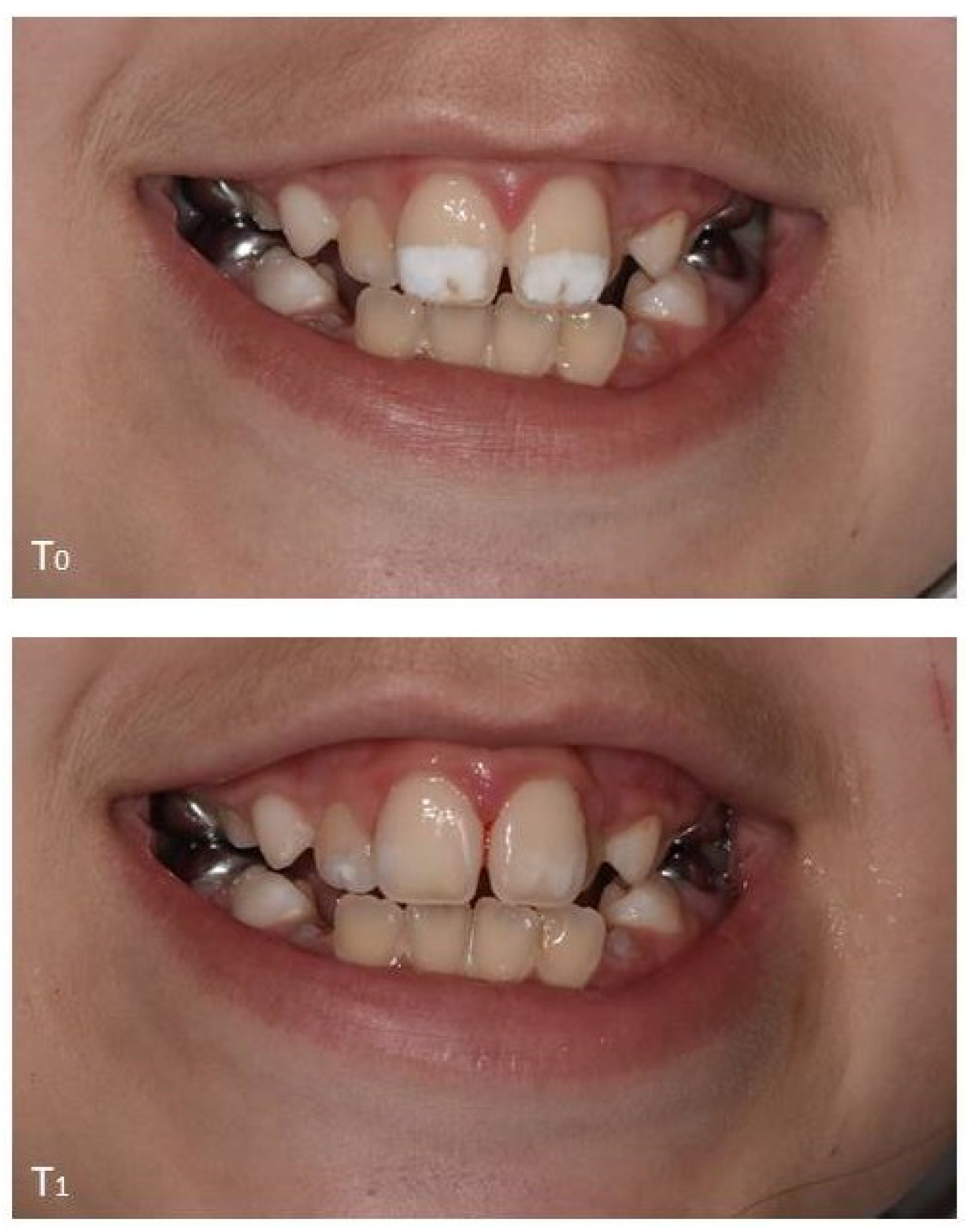Dentistry Journal Free Full Text Change In Oral Health Related