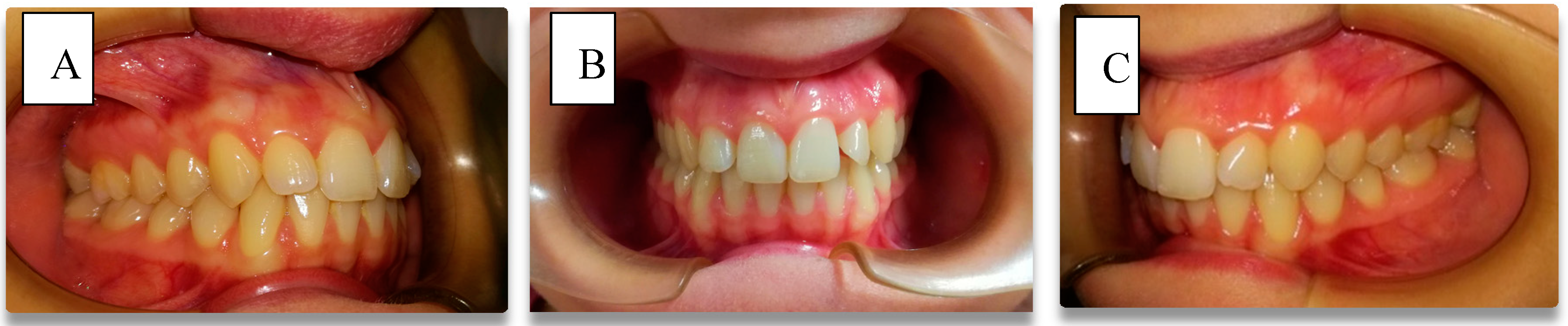 Dentistry 06 00062 g002