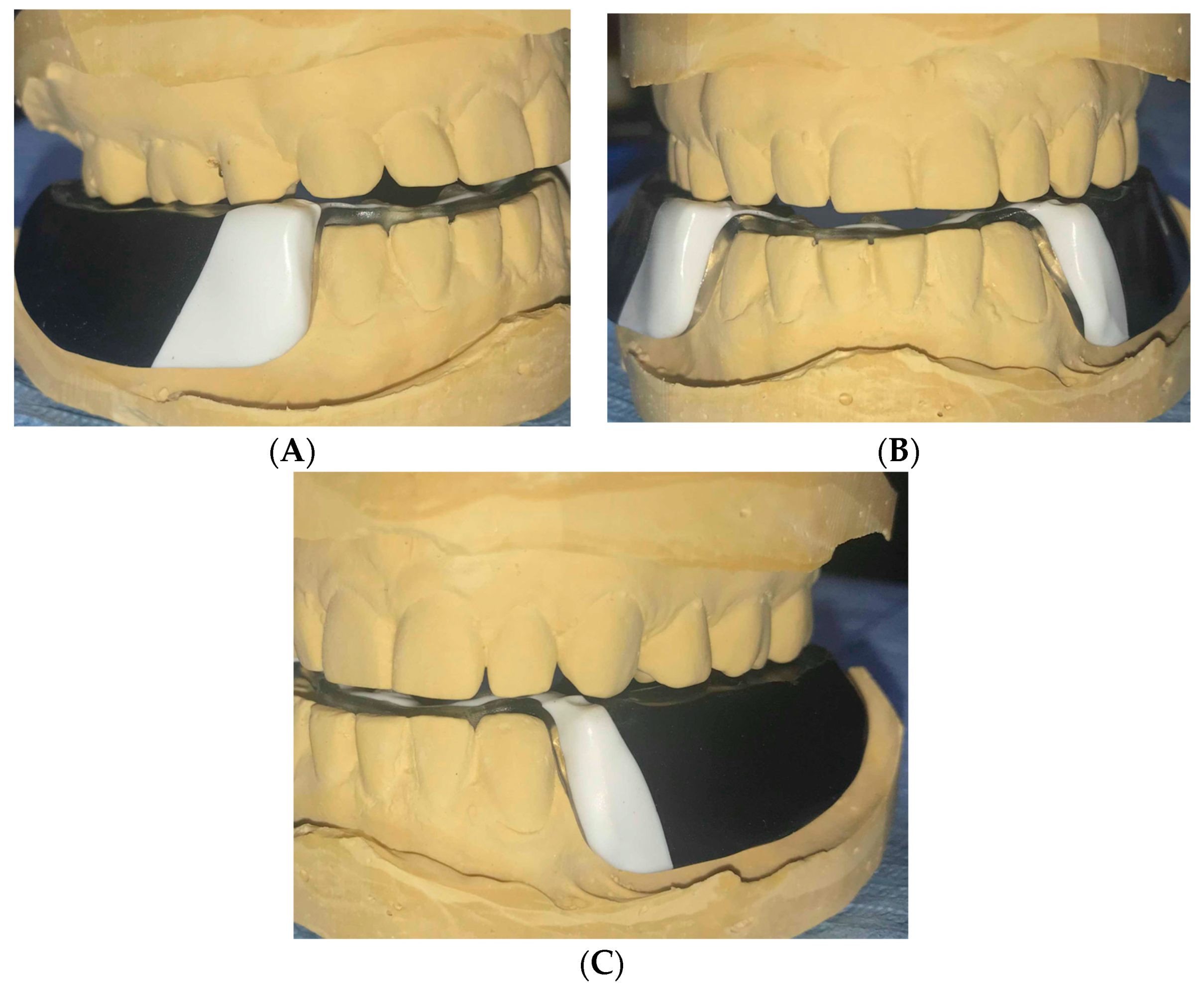 Dentistry 06 00063 g005