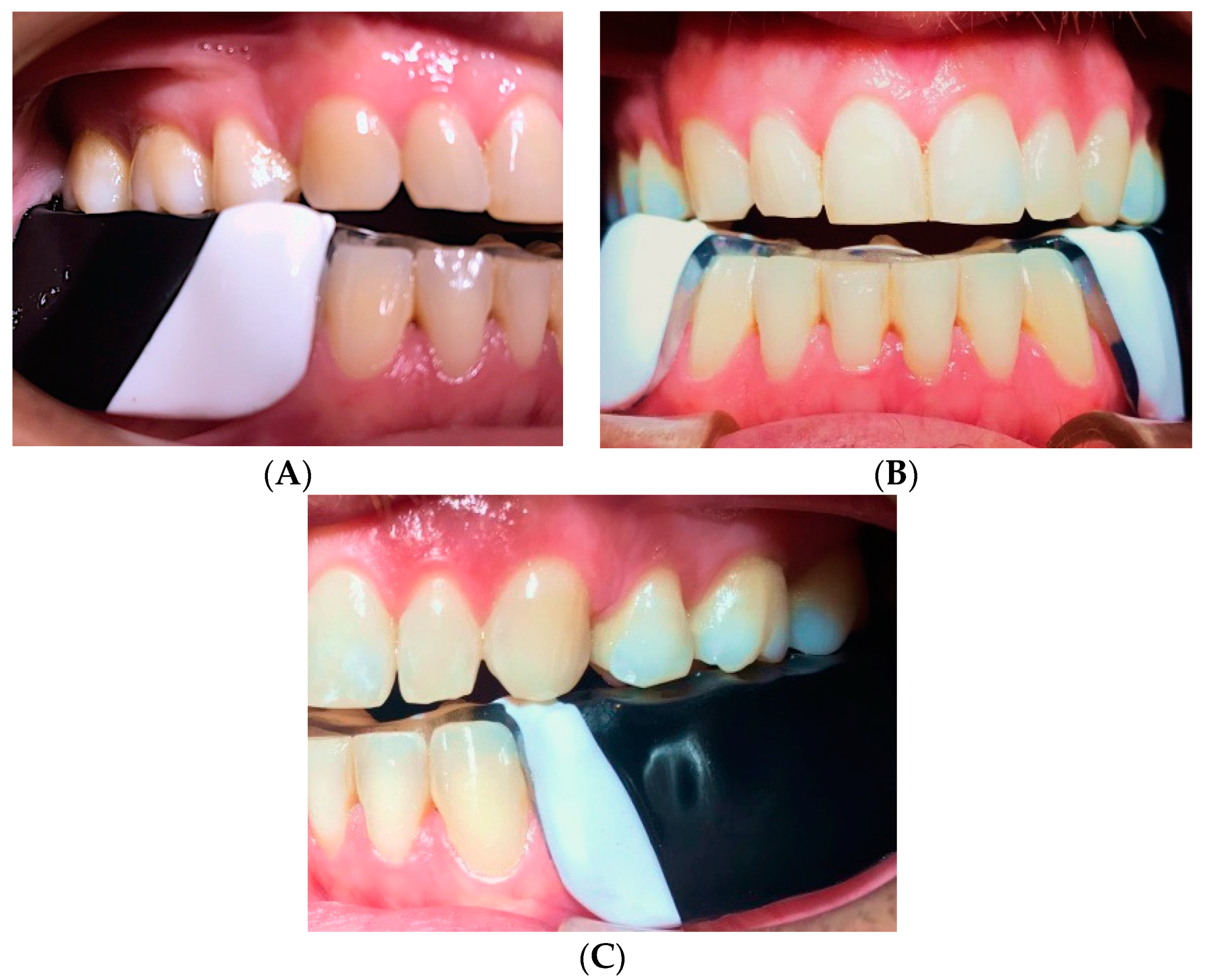 Dentistry 06 00063 g010