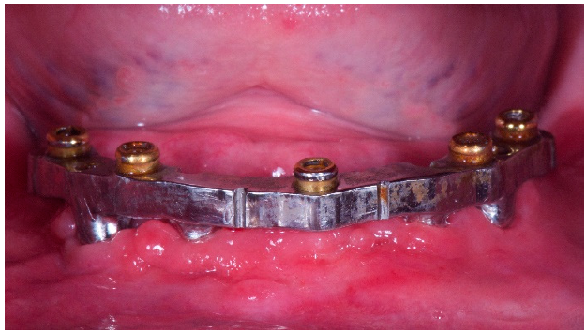 Dentistry 06 00071 g003